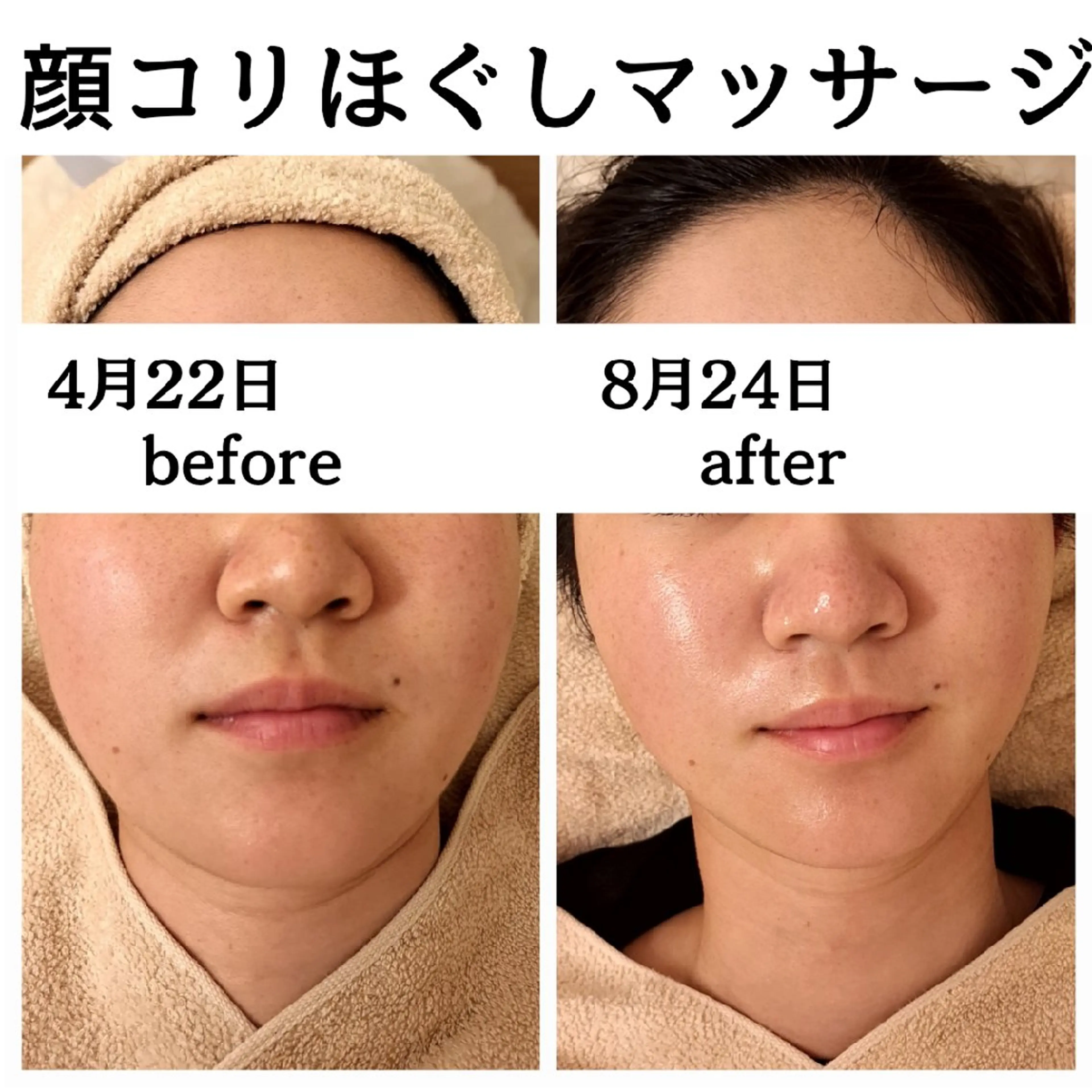 【毛穴/小顔/食いしばり】小顔マシン+毛穴洗浄&血流リンパマッサージ+顔ほぐしマッサージ+美容液導入　80分の写真