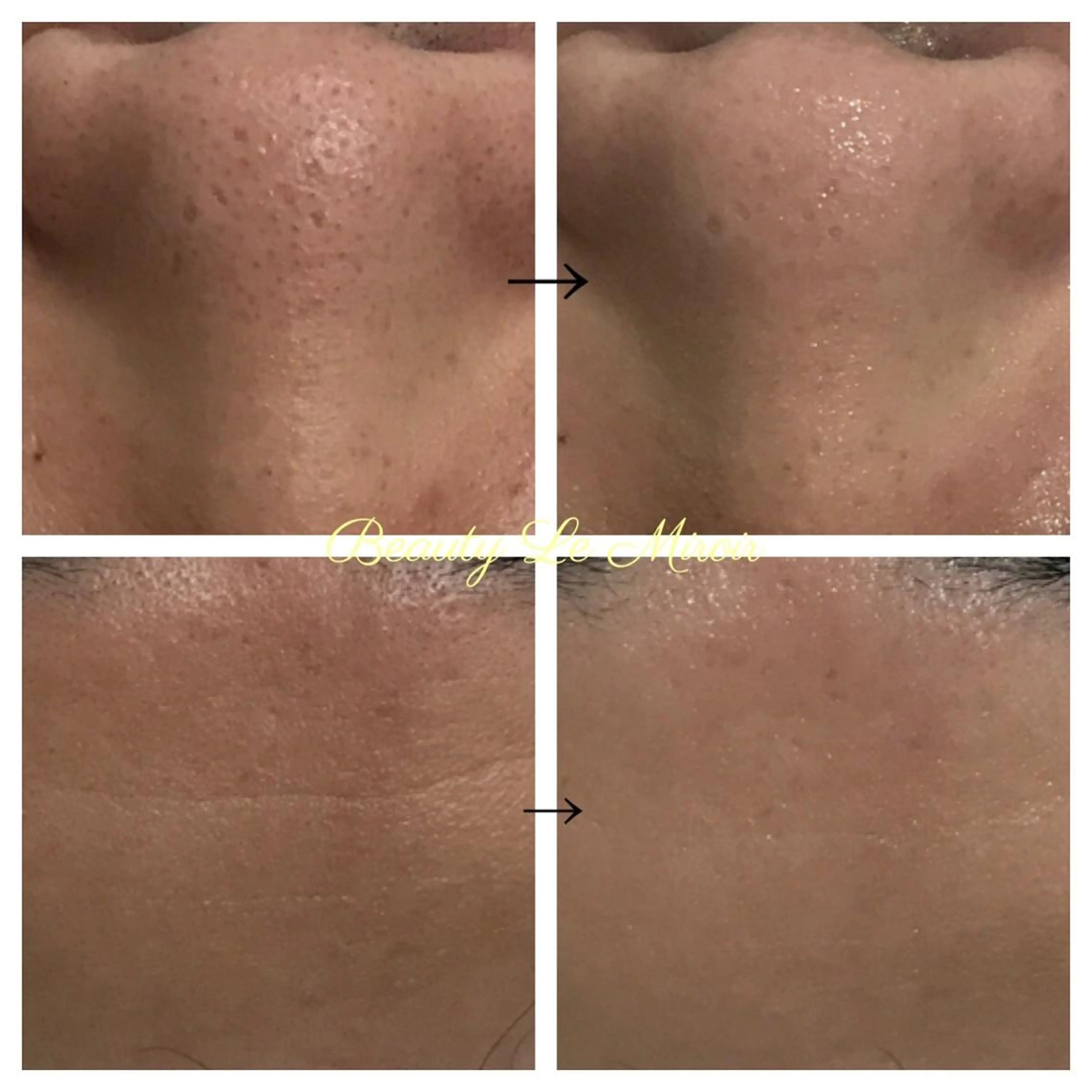 ビューティー ミロワールのエステ・リラクイメージ