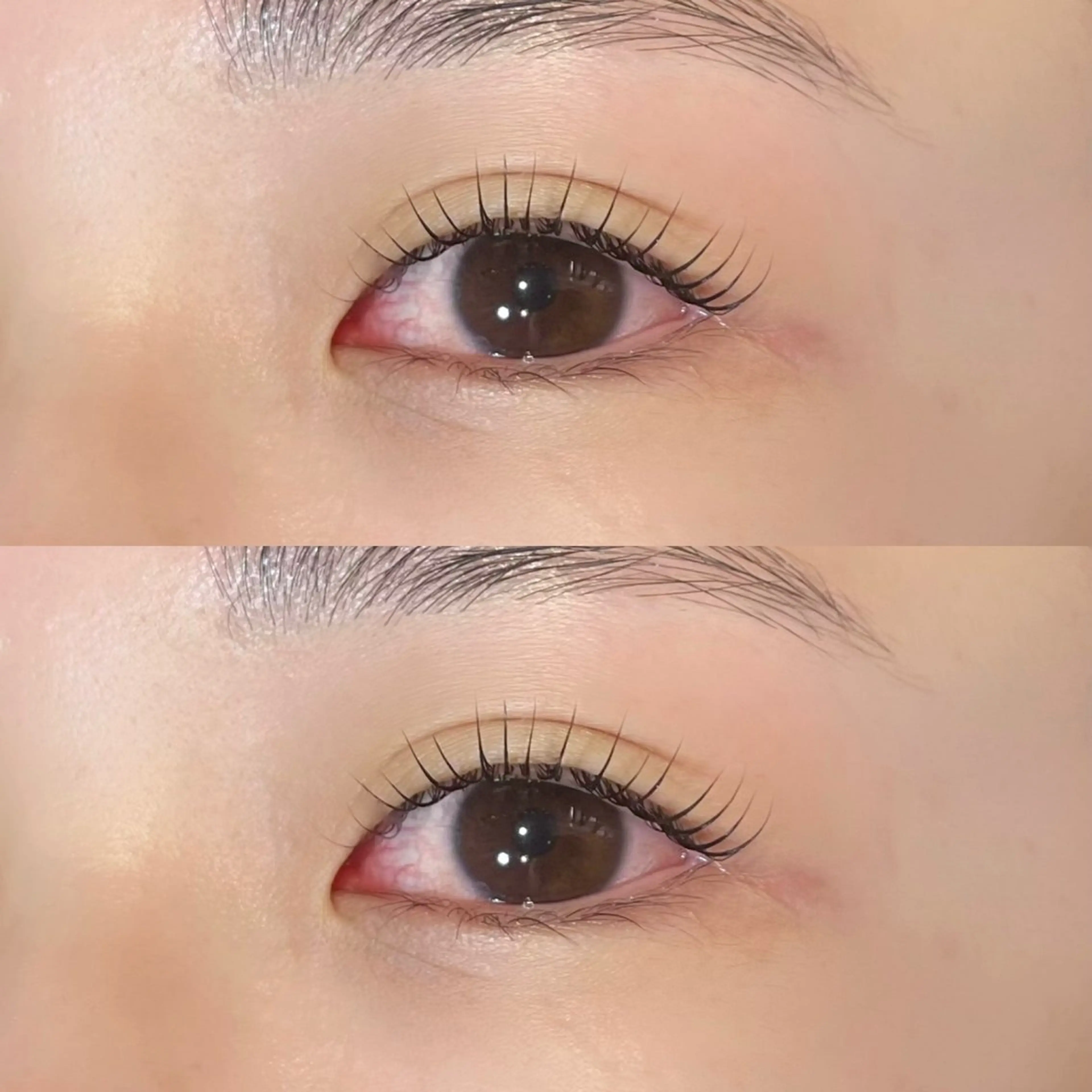 ใใใจใฏใปใใใ ๐๐๐๐๐ ๆ่ฑใฎใใใจใฏใปใใใใใถใคใณ