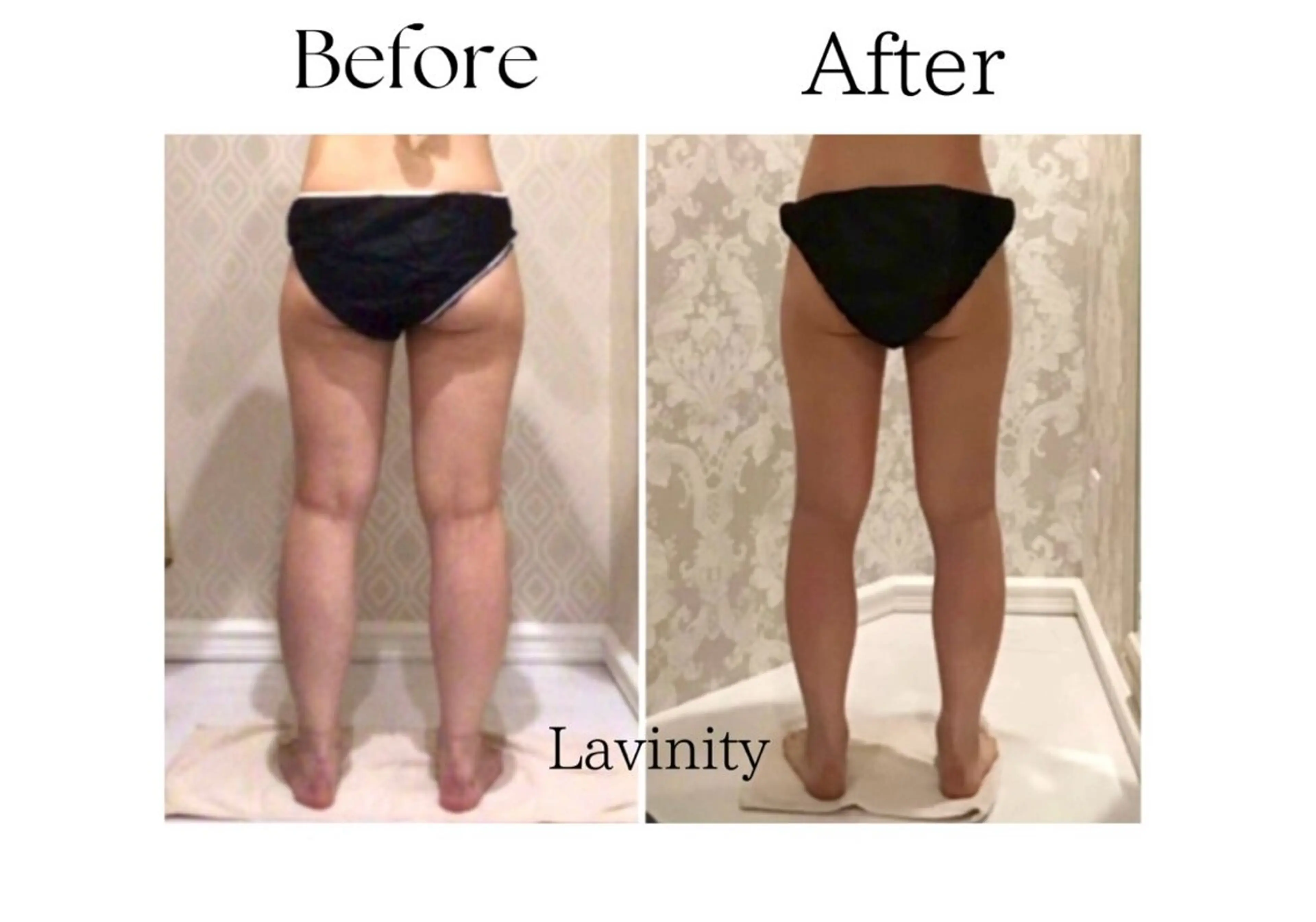 ラヴィニティ 自由が丘店のエステ・リラクイメージ