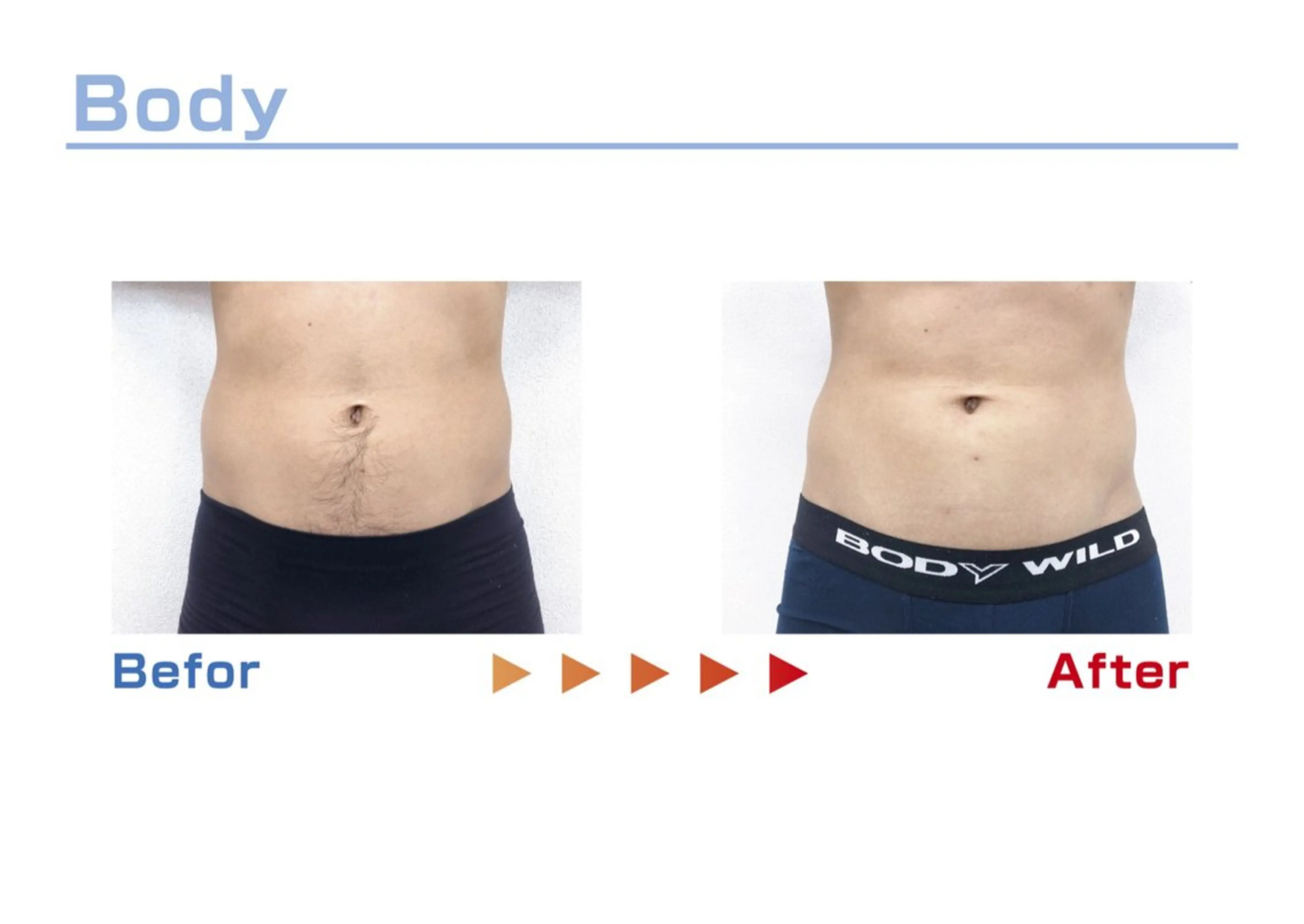 セルフ脱毛/美尻イス キングスサロン熊本のエステ・リラクイメージ