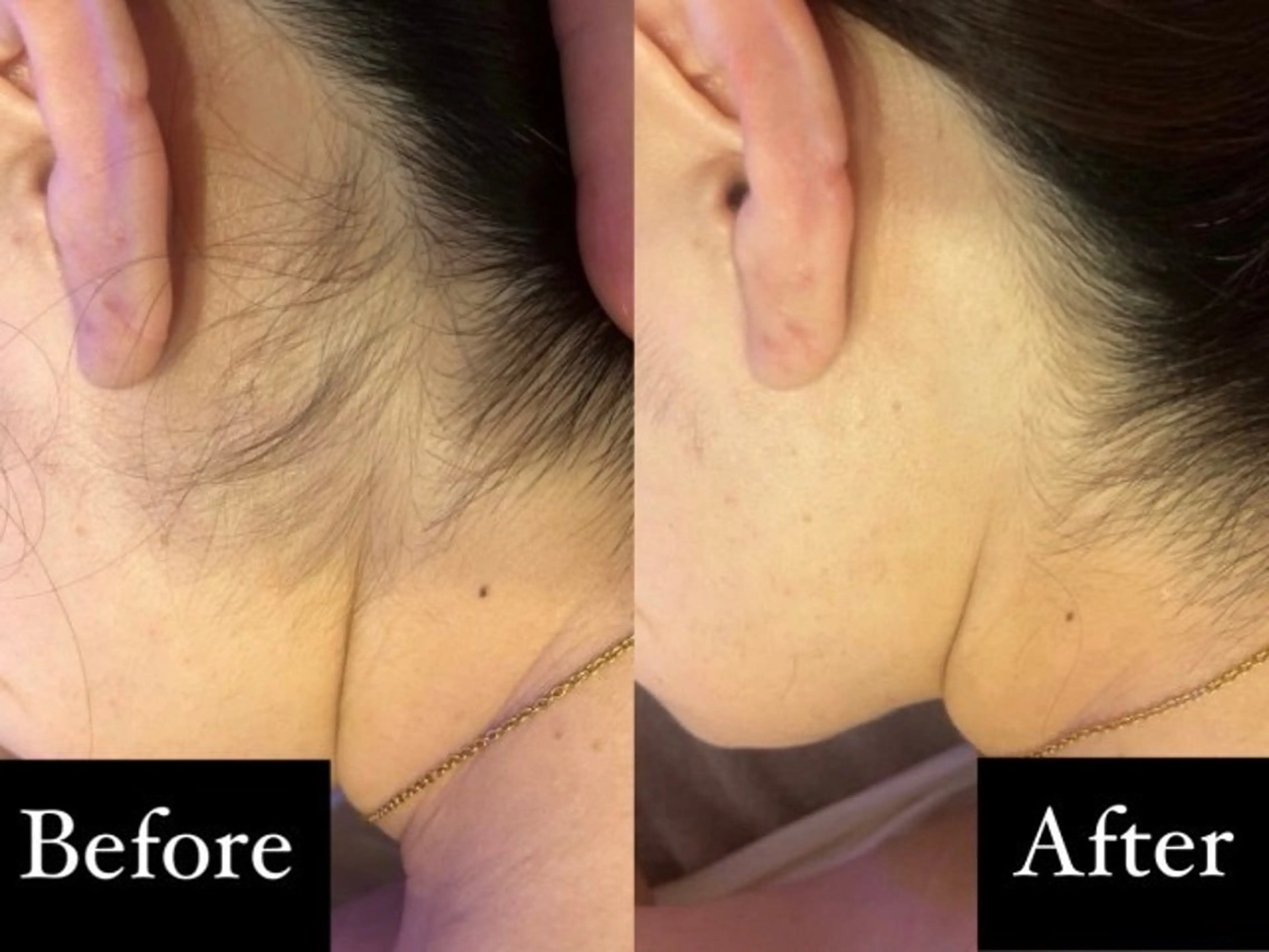 脱毛 POPOのエステ所属・popoのエステ arisaのエステ・リラクイメージ