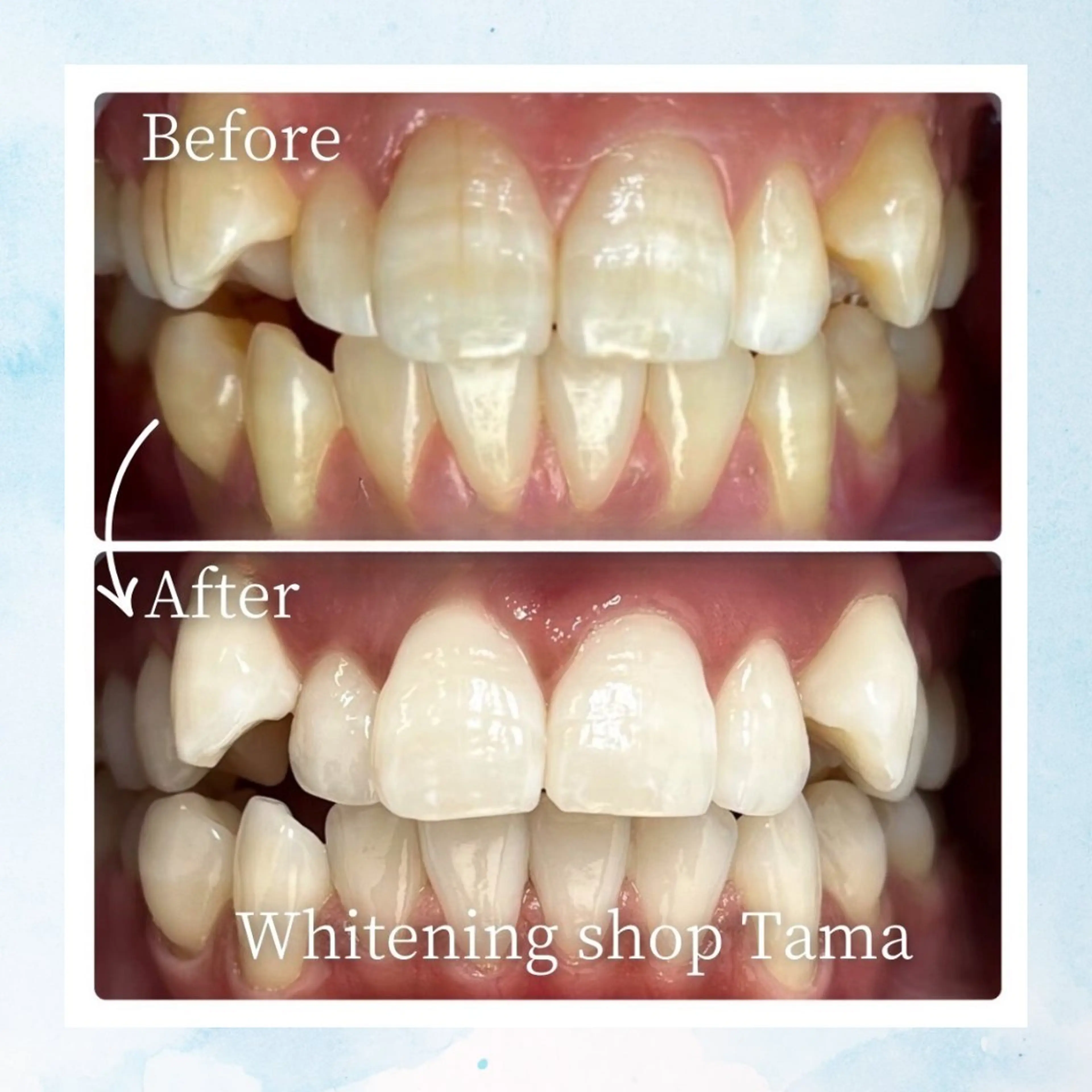 ホワイトニング ショップ多摩店のその他イメージ