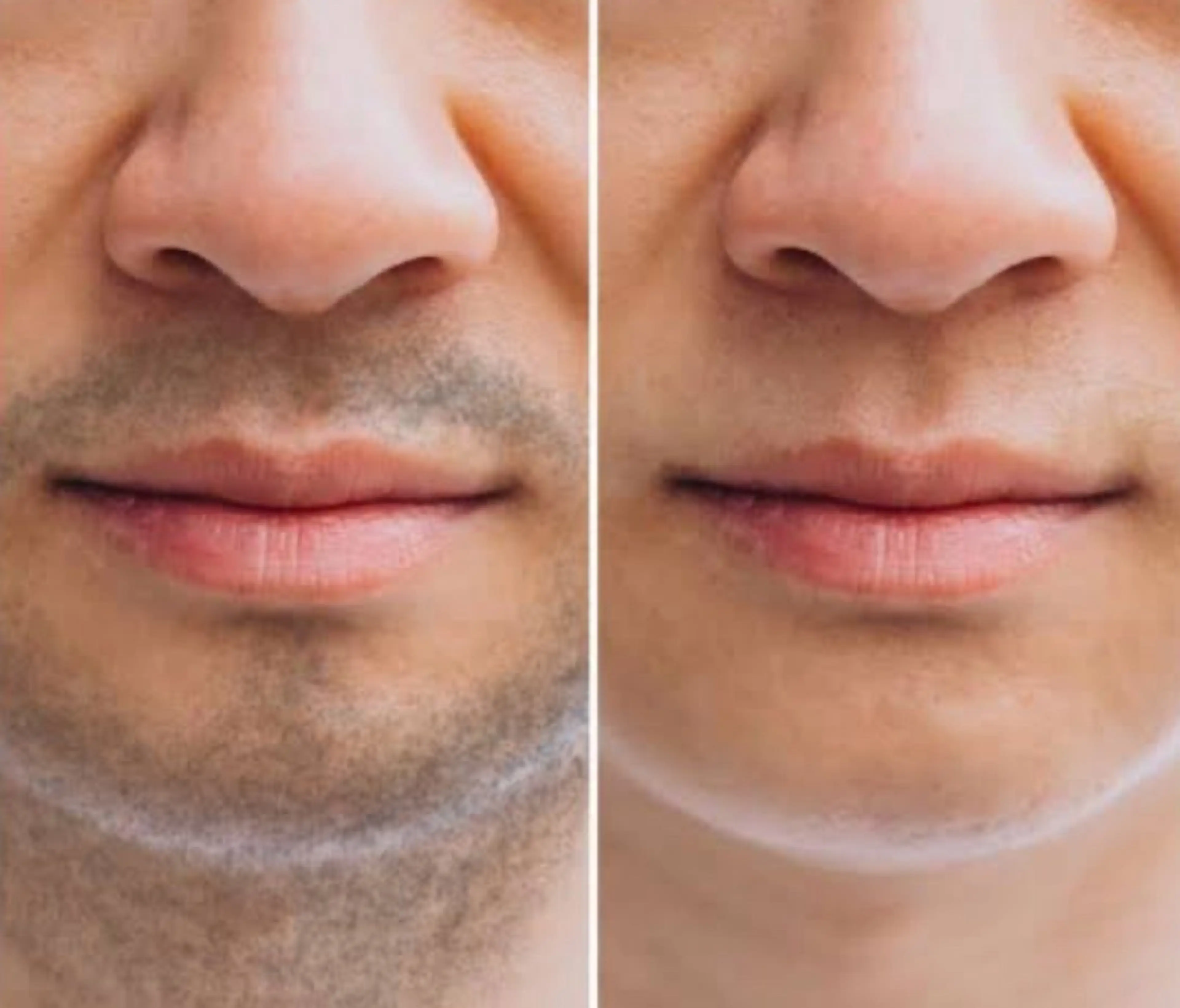 メンズ 脱毛 【光＆WAX脱毛】セラヴィプライベートサロン（メンズ・キッズも可）所属・kaise makiのエステ・リラクイメージ