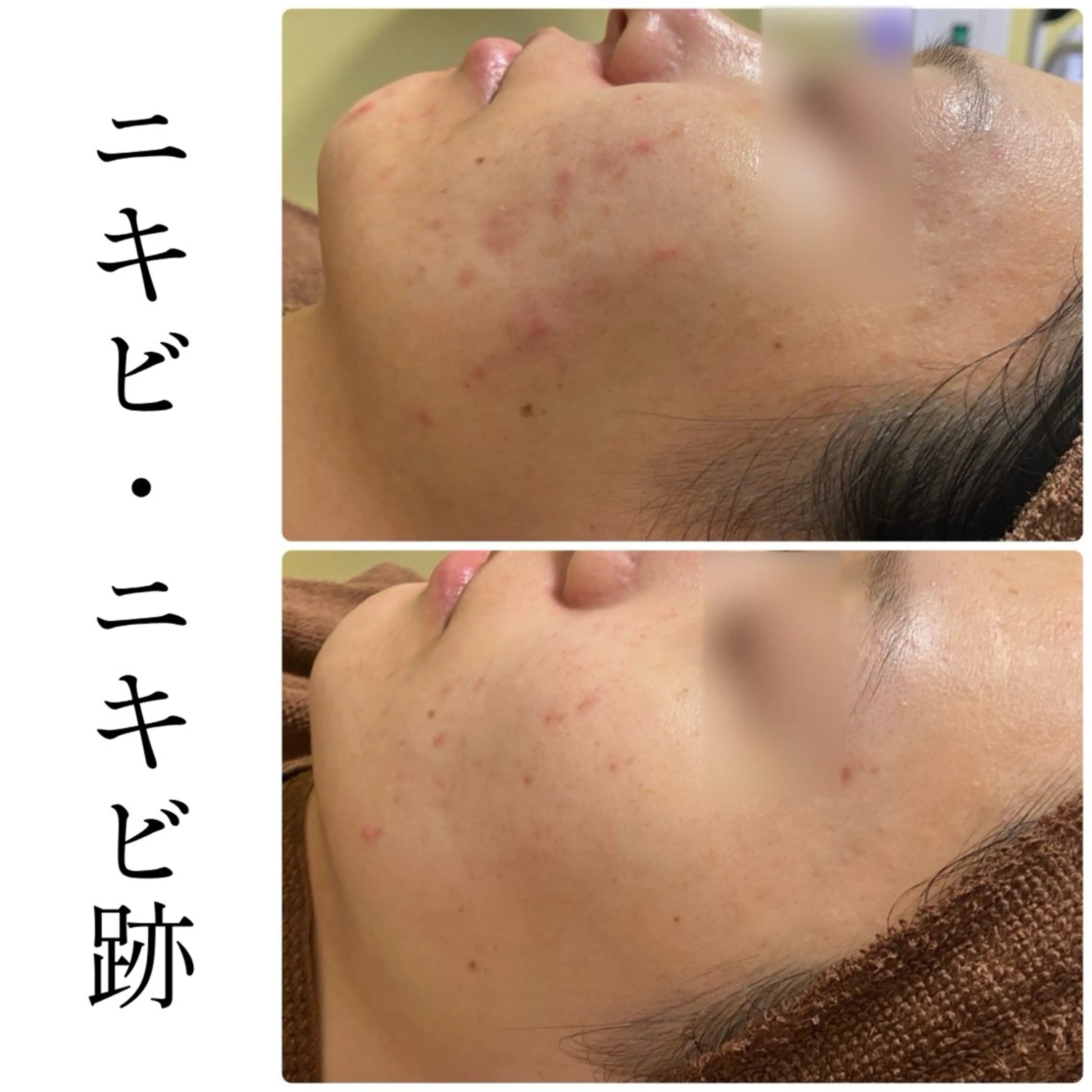 ハーブピーリング専門 BIOEL横浜のエステ・リラクイメージ