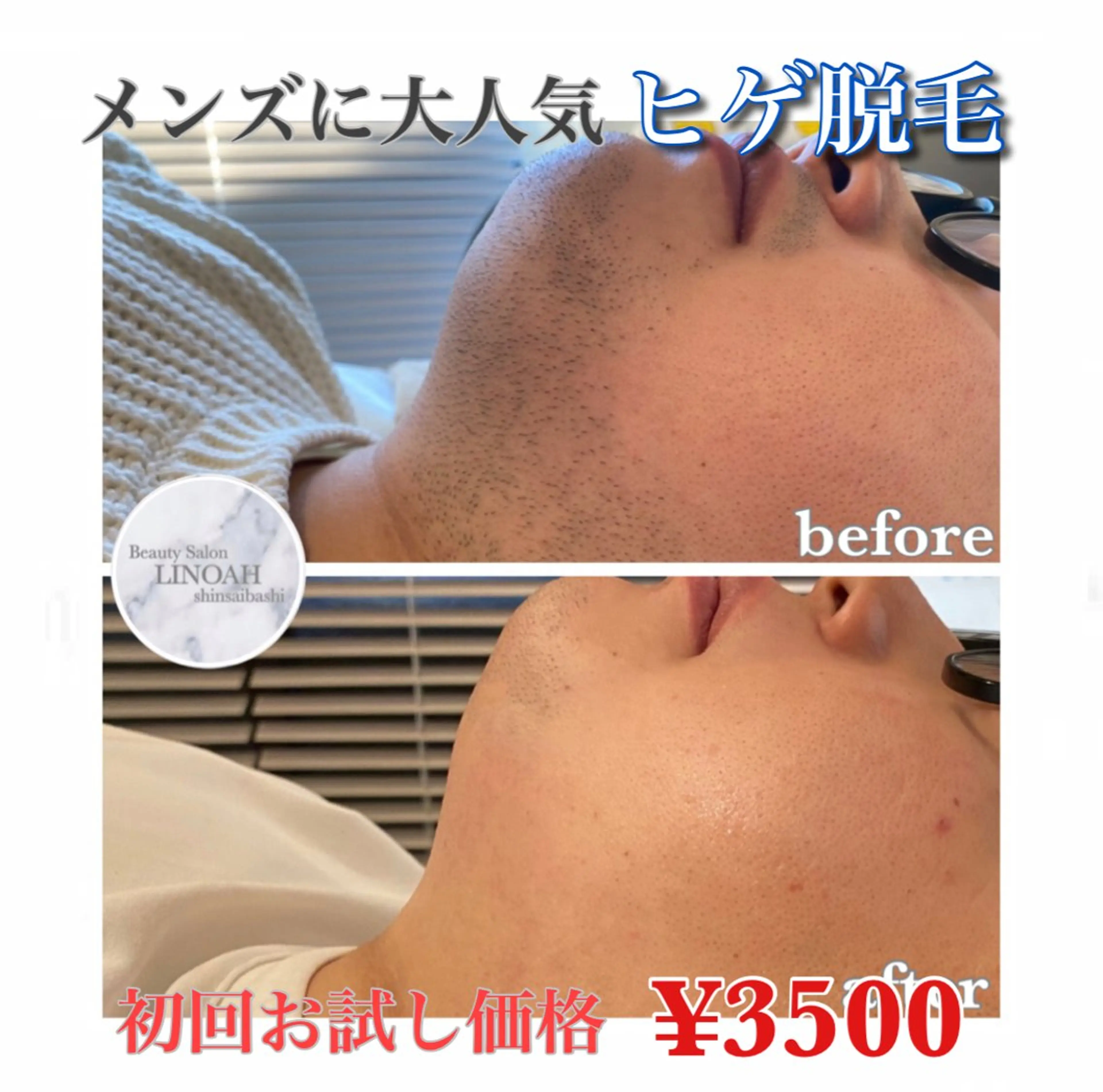 メンズ ビューティーサロン リノア心斎橋店のエステ・リラクイメージ