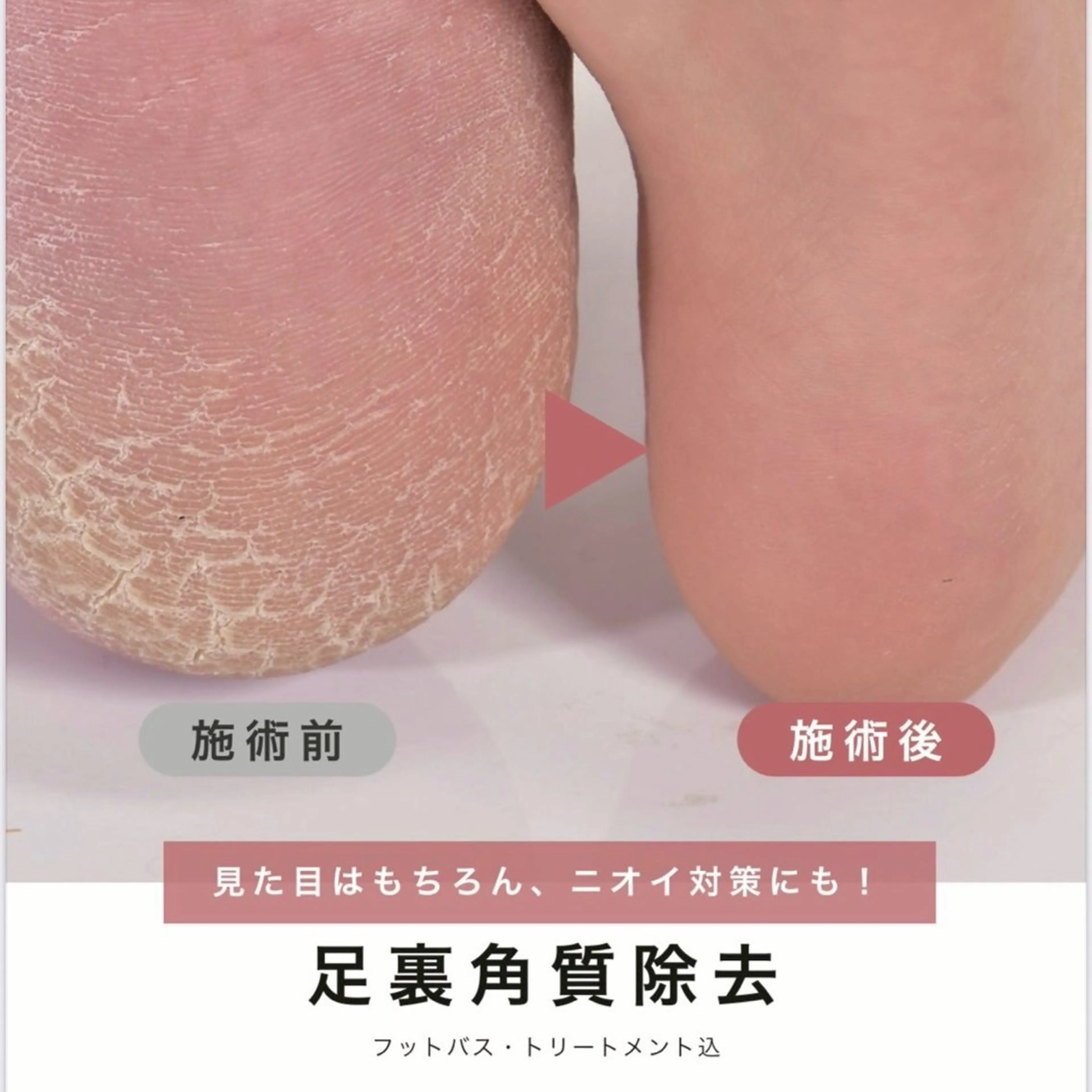 リラク Bianca 栄店 Sanoのマツエク・マツパデザイン