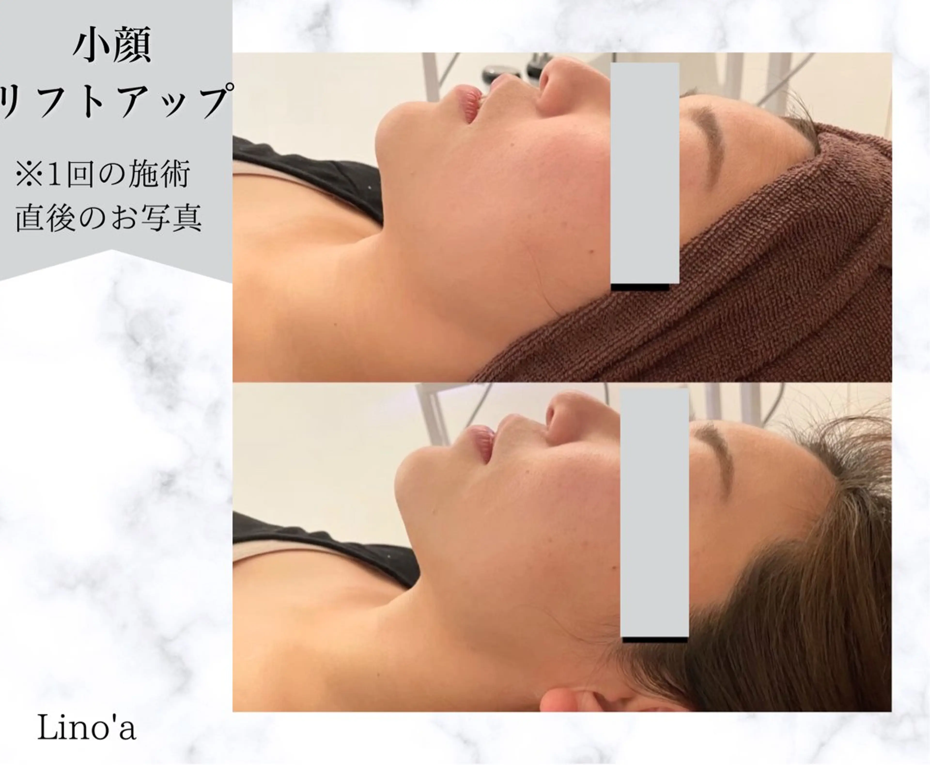 エステ リラク Salon💫 Lino'a柏店のエステ・リラクイメージ