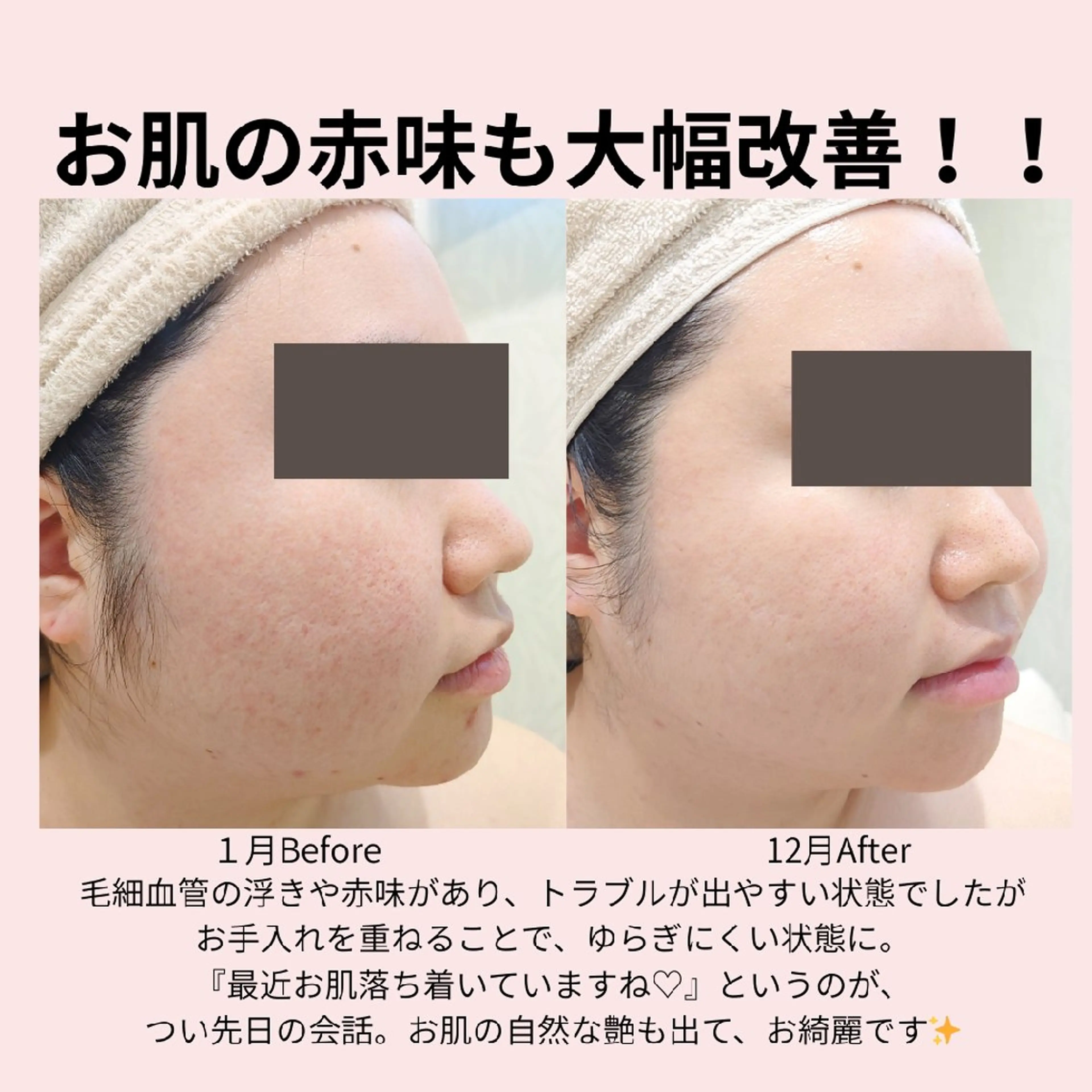 エステ PRETTIEST SHINE所属・フェイシャル/ボディ /ブライダル山田浩子のエステ・リラクイメージ