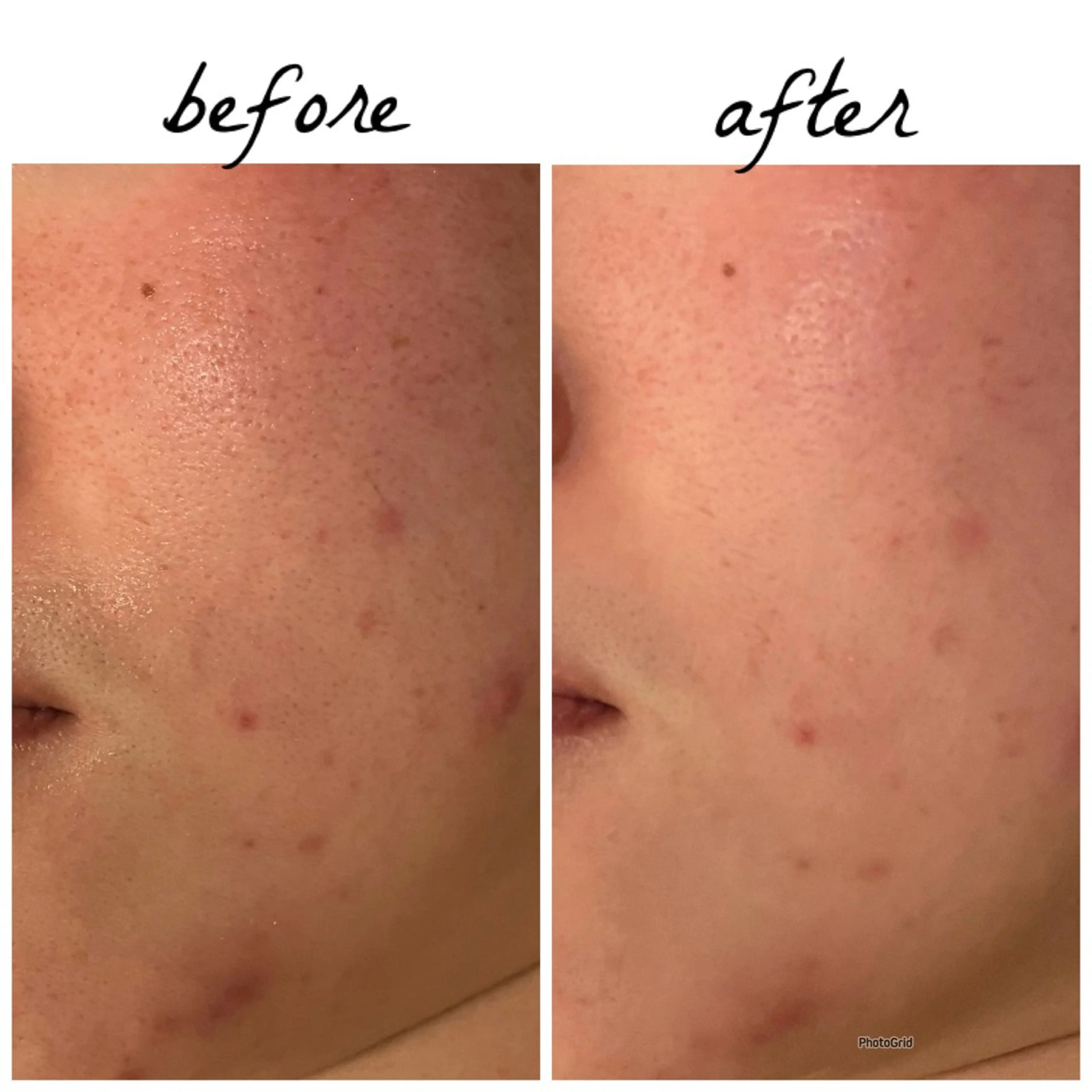 メンズ メナード岐阜茜部 杉浦のエステ・リラクイメージ