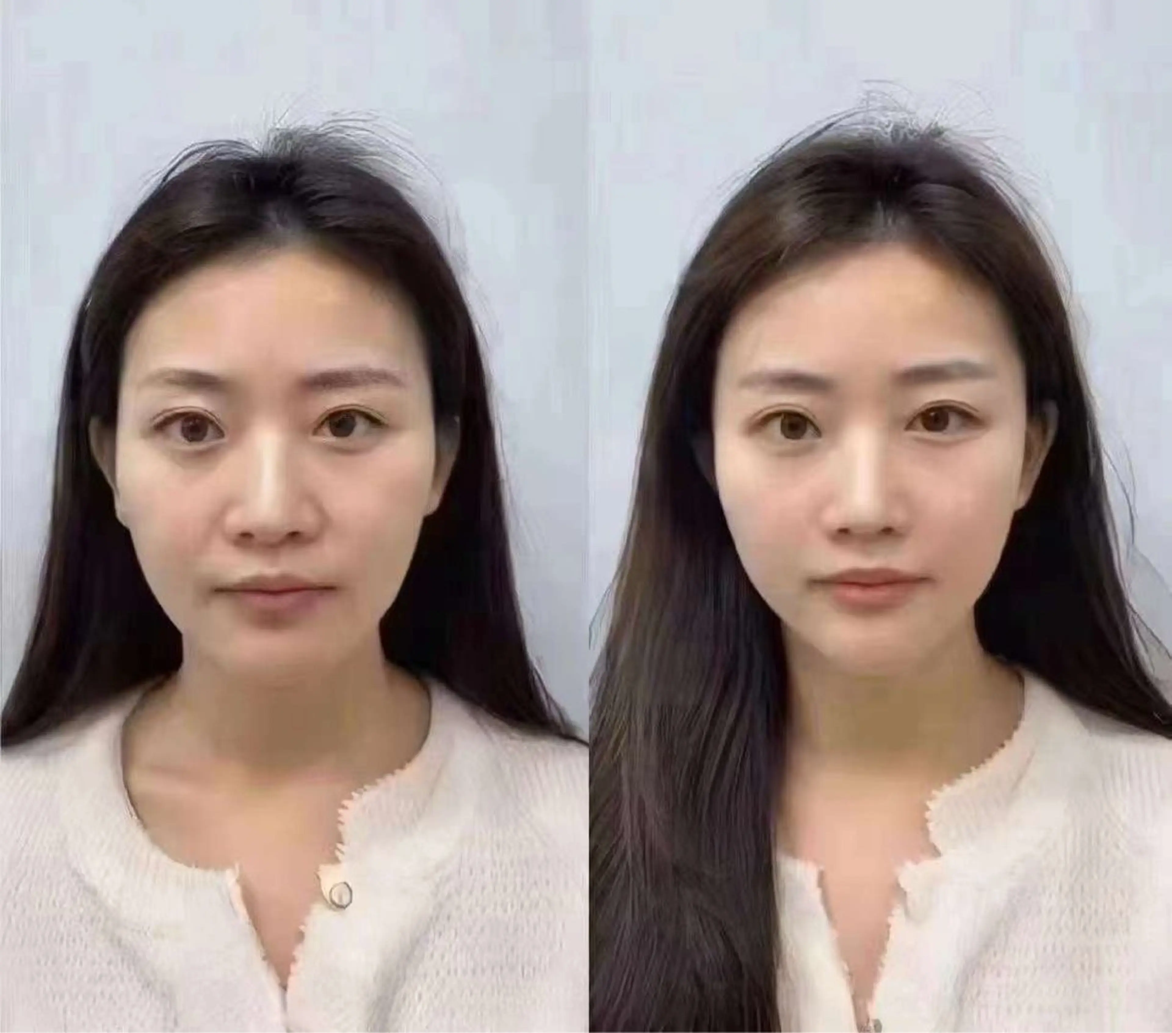 マツエク・マツパ エステ aliaハイフ&水光ジェットサロン所属・aliaハーブ水光店 エステティシャン募集のエステ・リラクイメージ