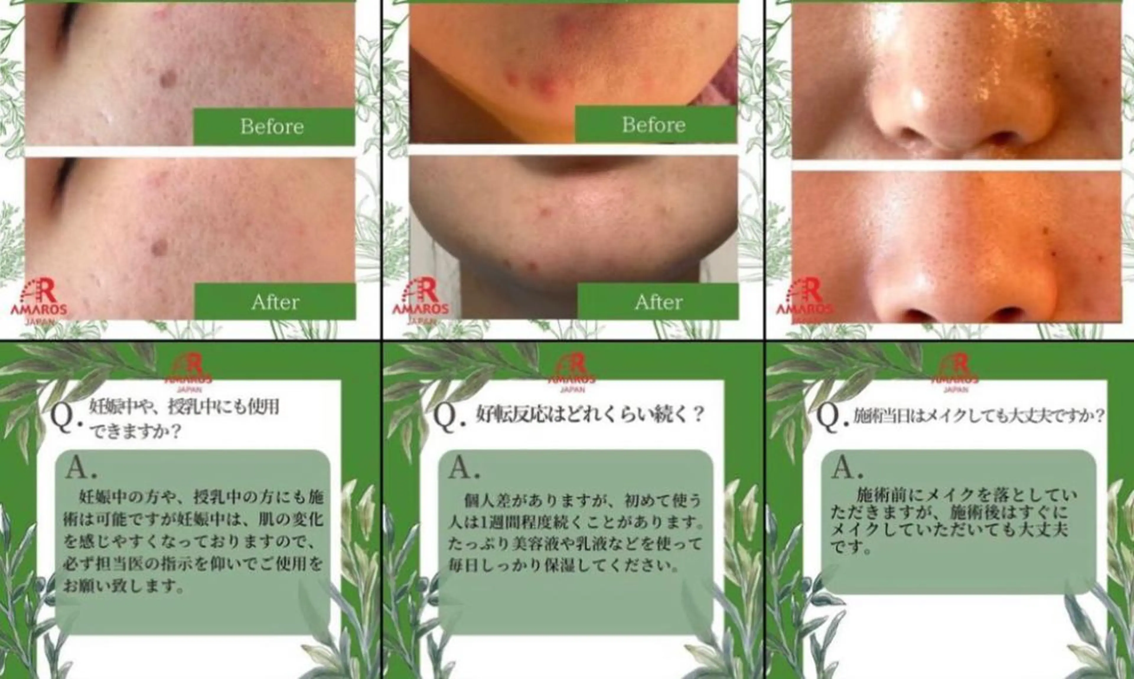 メンズ エステ リラク beauty salonnのエステ・リラクイメージ