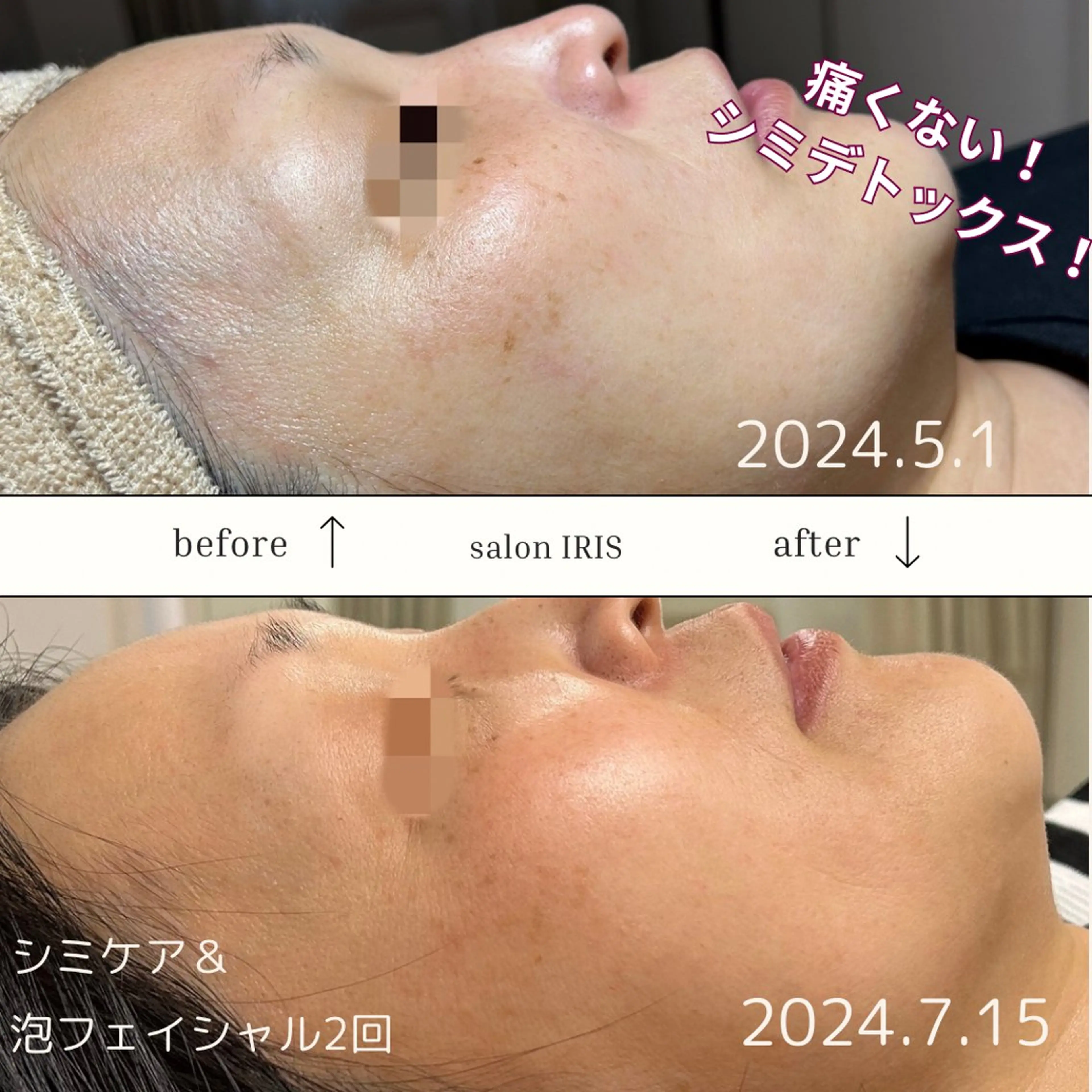 エステ ASAI CHIZURUのエステ・リラクイメージ