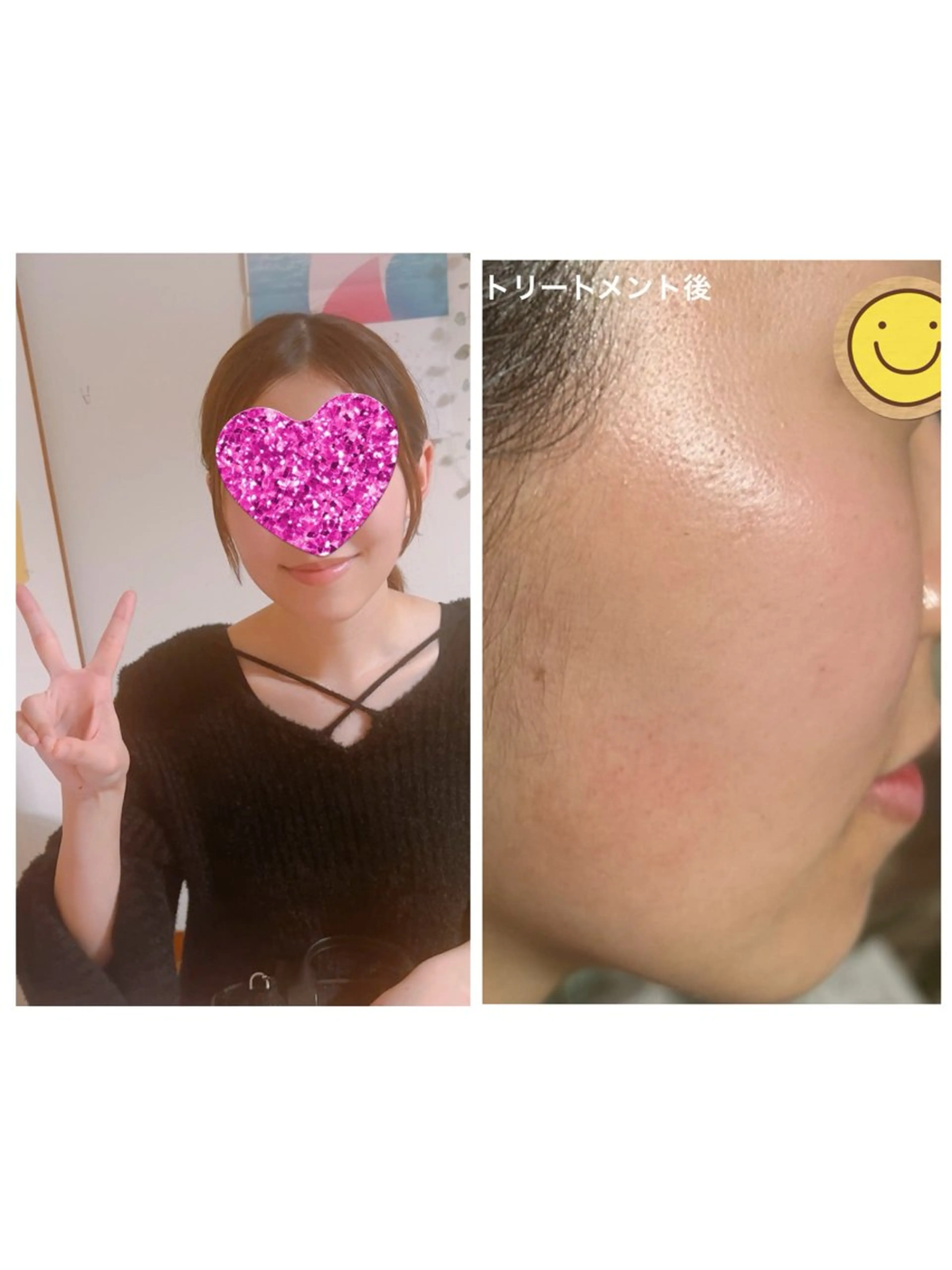 ノエビアビューティースタジオセレンディピティ所属・ノエビアビューティー セレンディピティのエステ・リラクイメージ