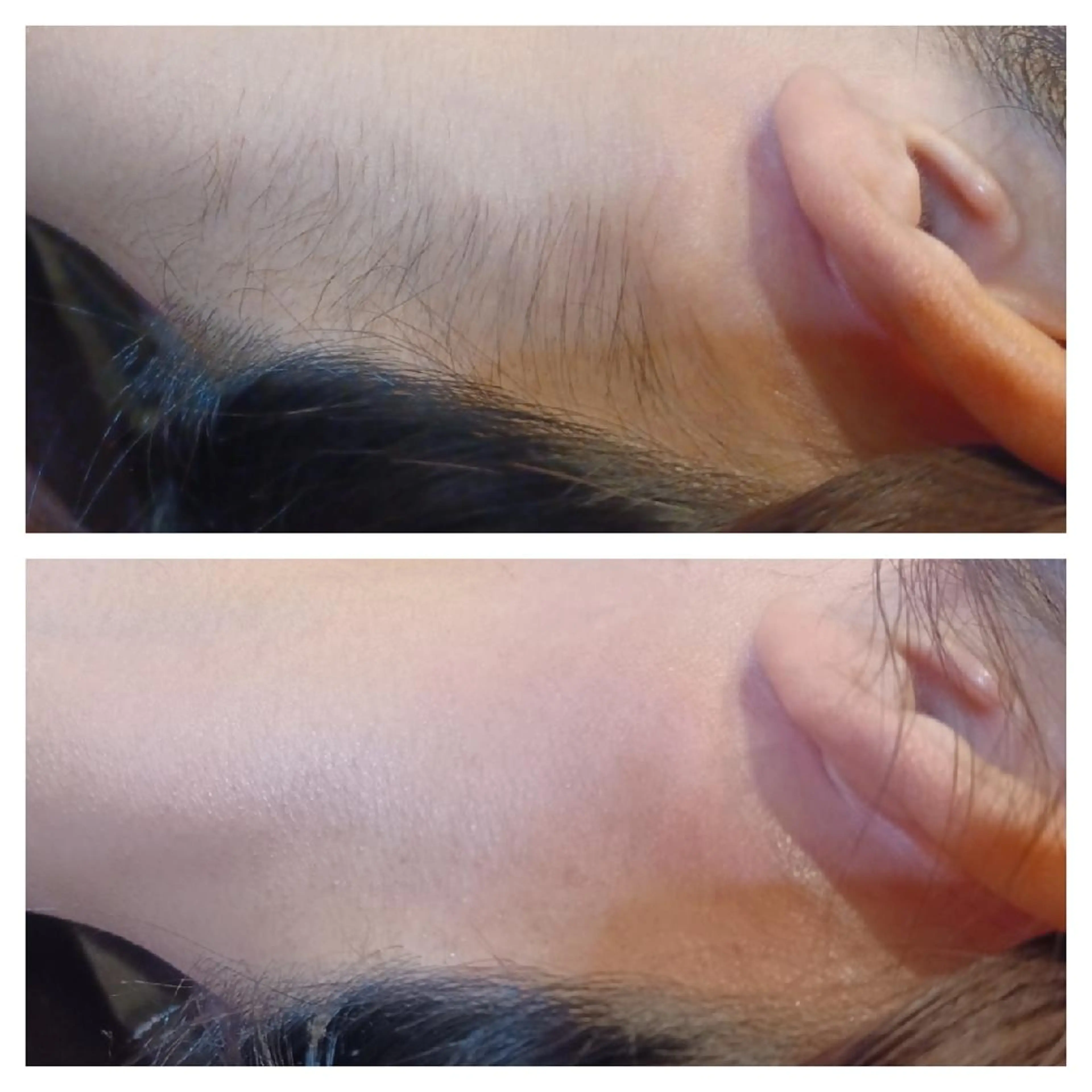 Lutella所属・ワックス脱毛専門店 Lutellaのエステ・リラクイメージ