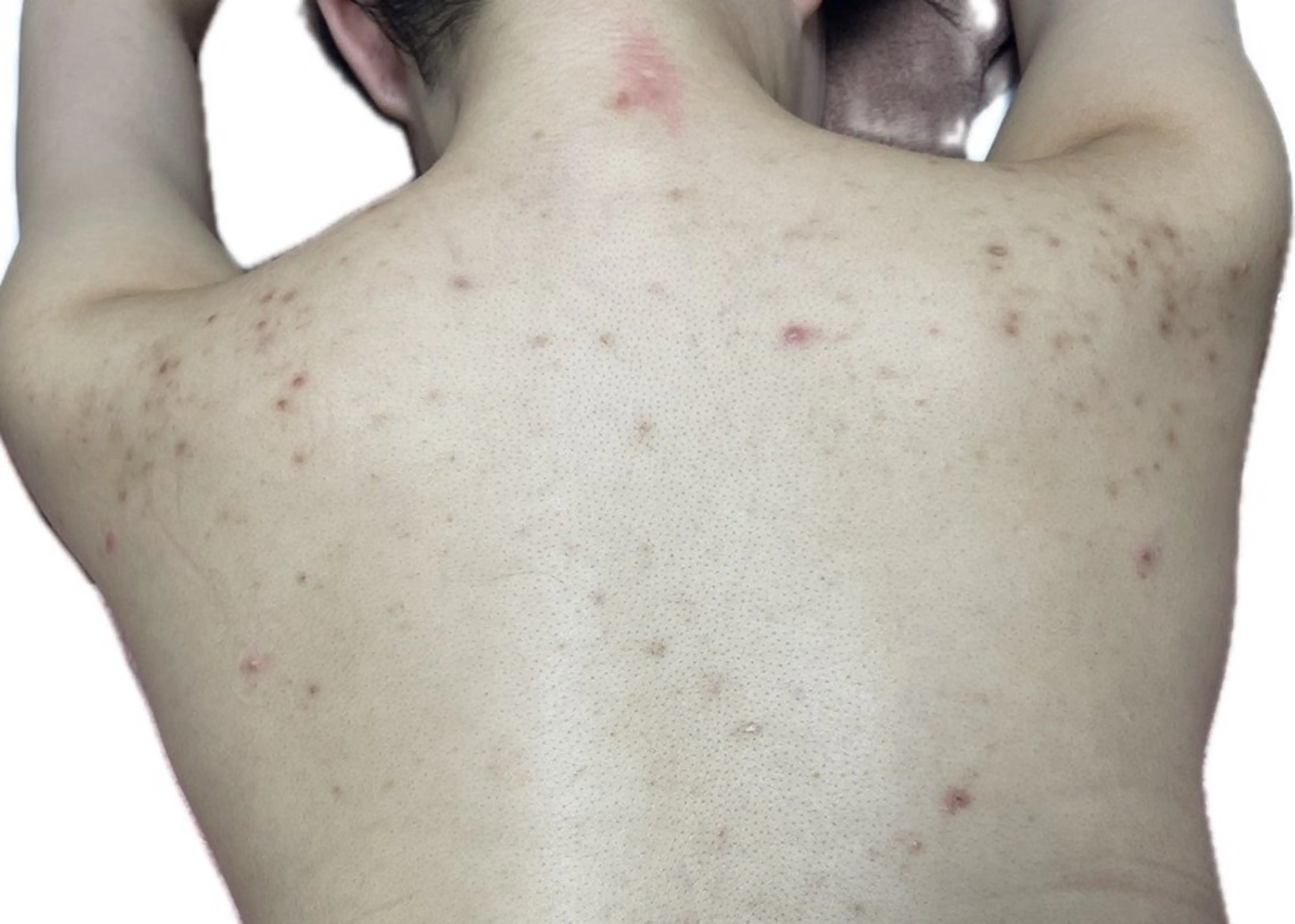 エステ リラク 透明感の肌Lino malieのエステ・リラクイメージ