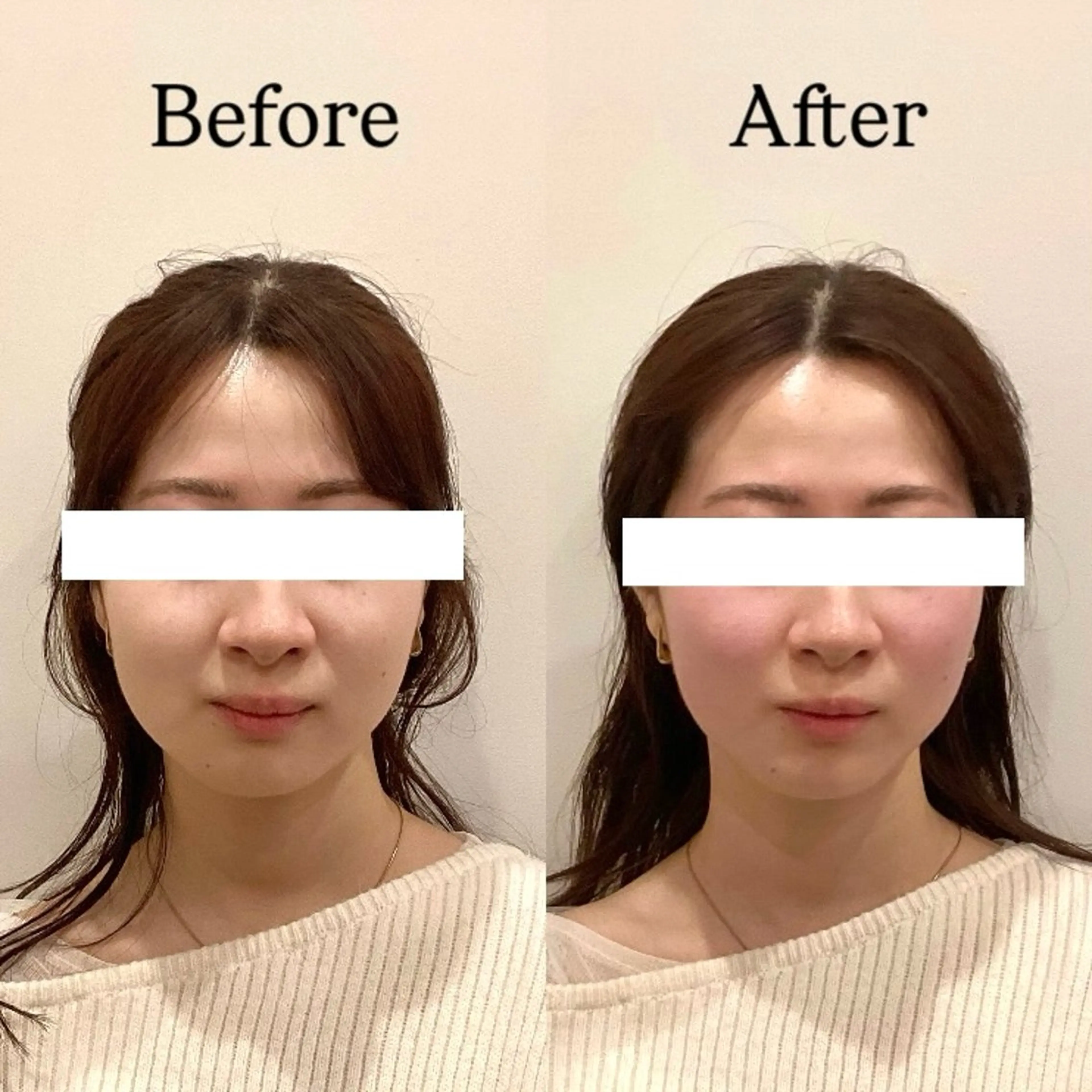 Hari Lounge恵比寿所属・chika🦋 ハリラウンジ恵比寿のエステ・リラクイメージ