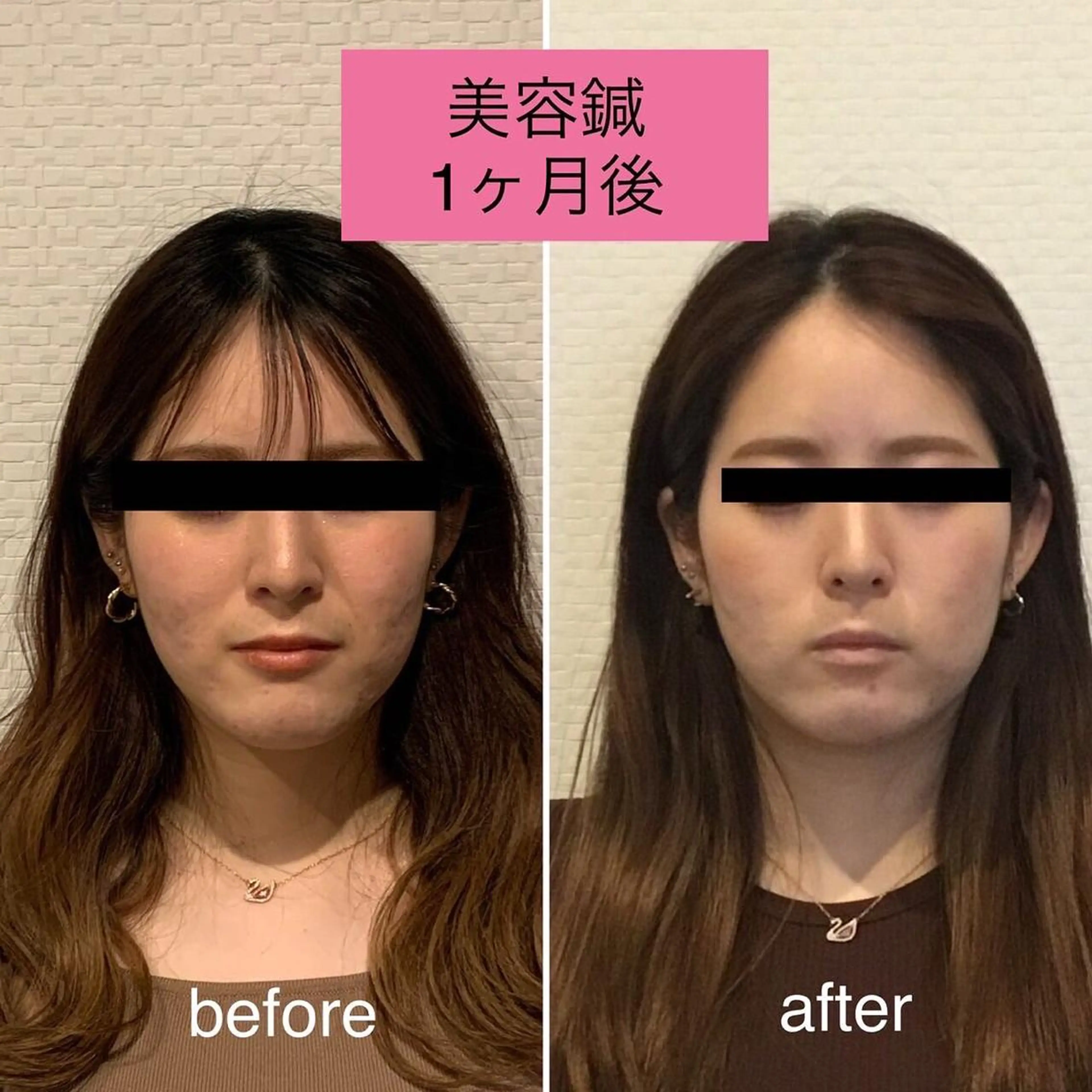 エステ チキバン美容鍼灸整体 サロン心斎橋店のエステ・リラクイメージ