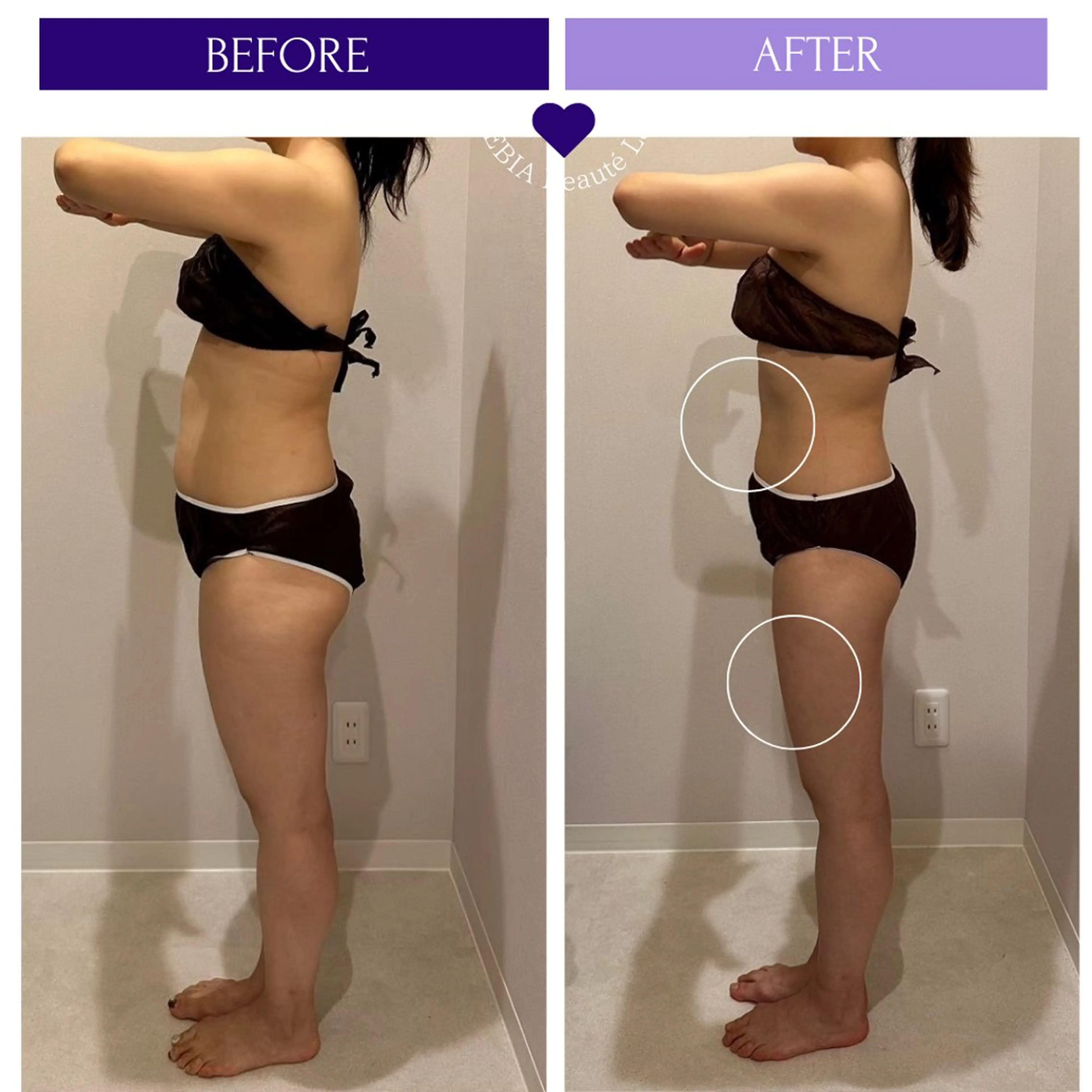 エステ リラク 小顔＆まつ毛サロン AKANE❤️のエステ・リラクイメージ