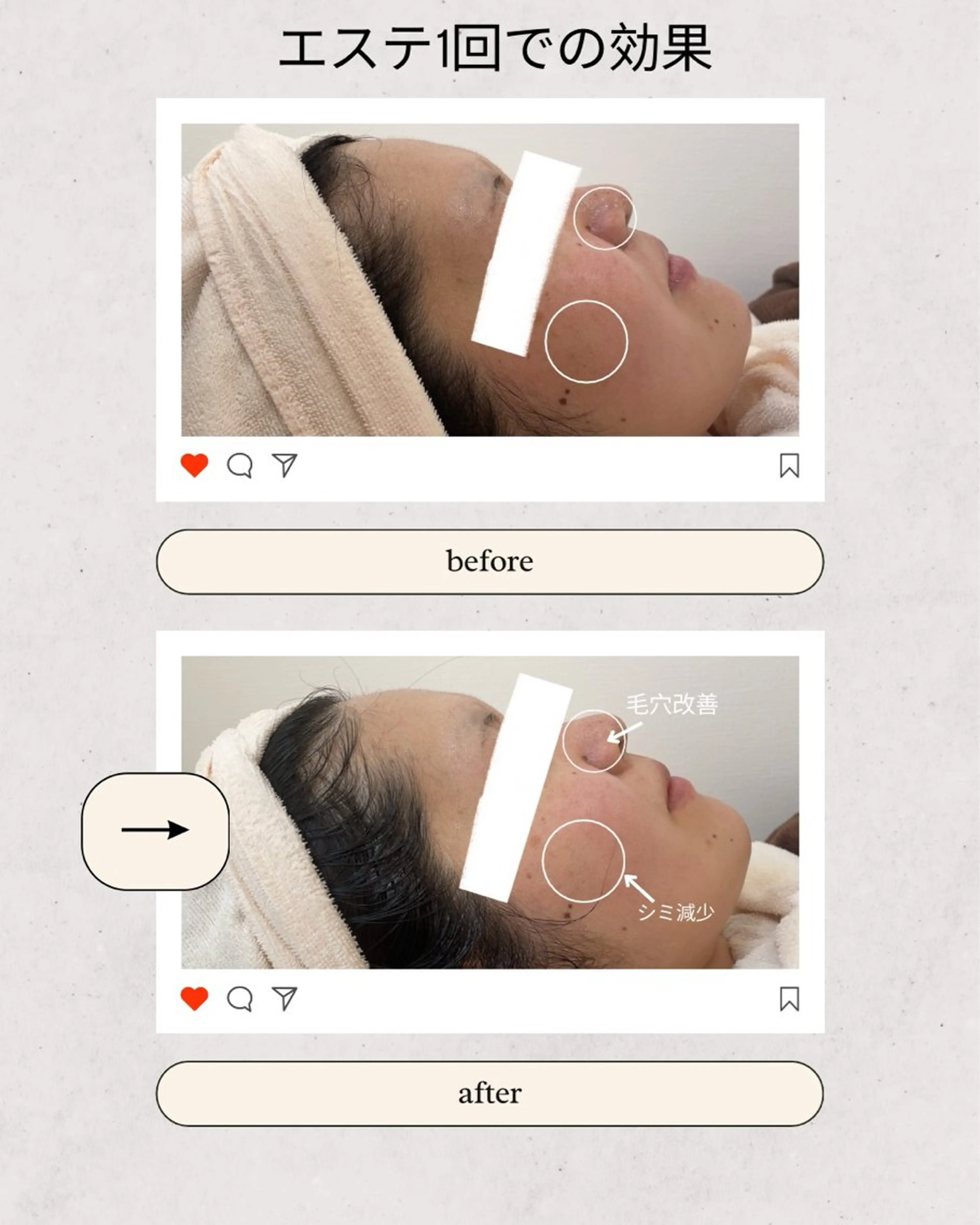 CSサロン Amule所属・🦋肌質改善サロン. anna🦋のエステ・リラクイメージ
