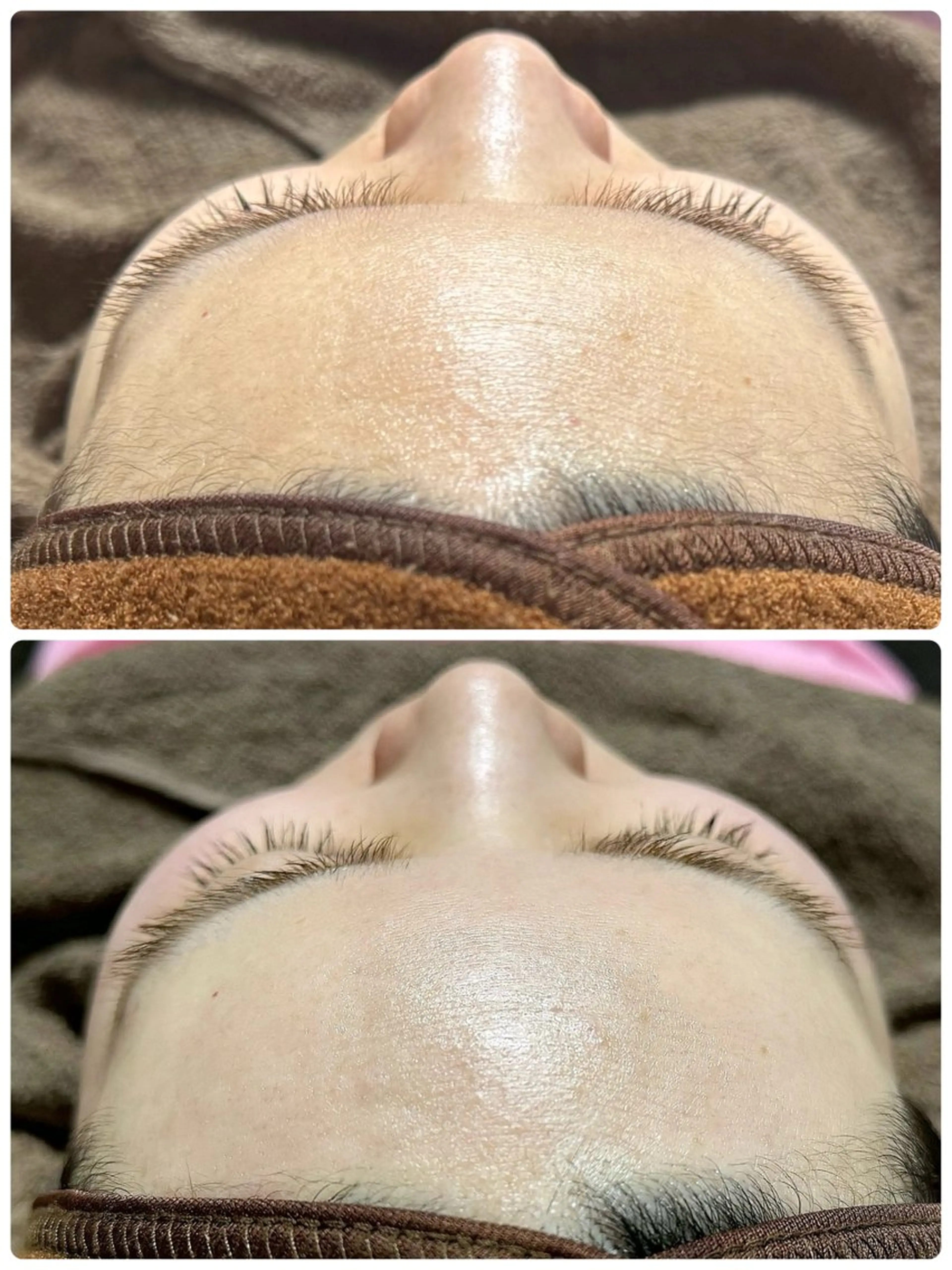 《ミニモ限定価格❤️‍🔥》お得なセットメニュー✨フェイシャル&うなじワックス脱毛🌿 ※当日予約不可※注意事項必読の写真