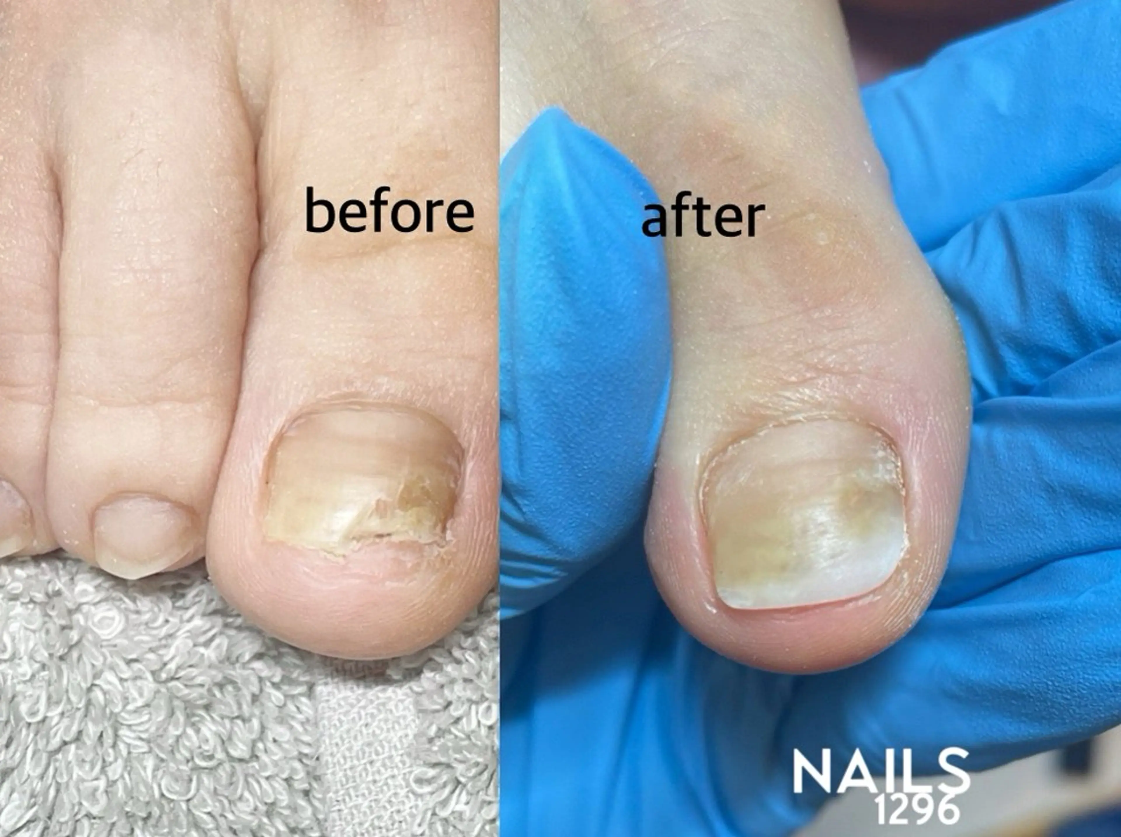 ネイル 長さ出し フットネイル ネイルチップ NAILS1296所属・YURIE ☺︎のネイルデザイン