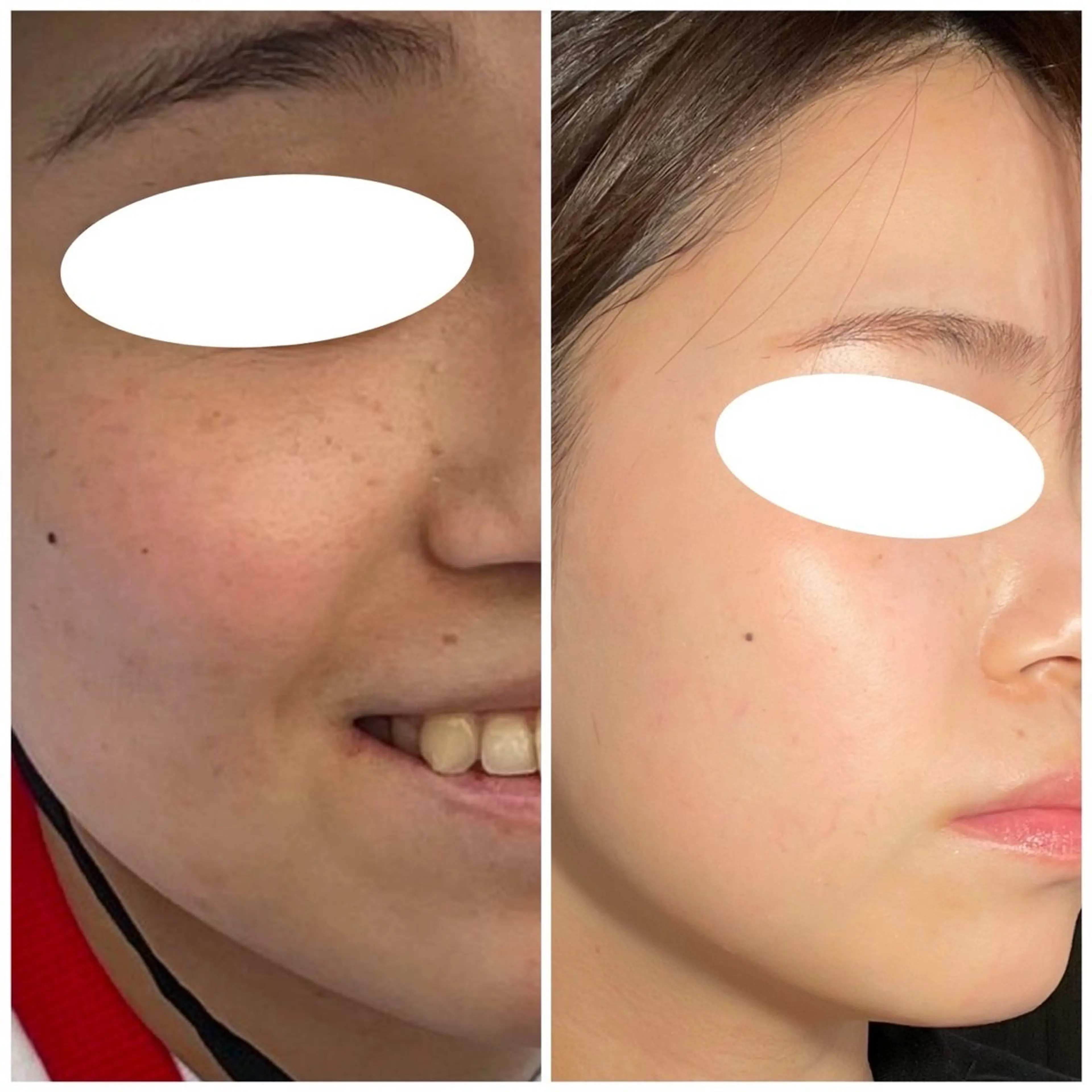 エステ leolo武蔵浦和 肌質改善＆脱毛のエステ・リラクイメージ