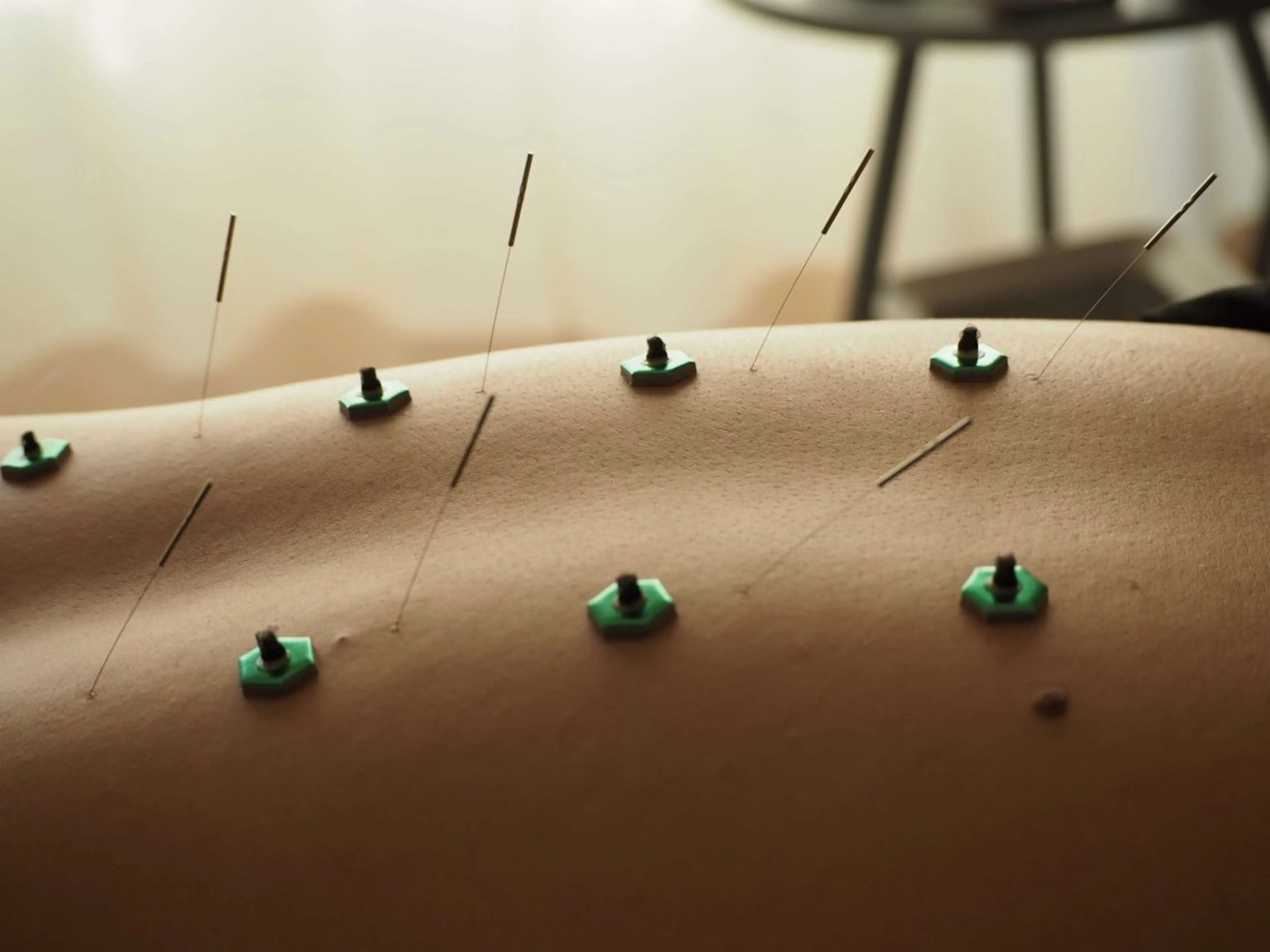 リラク 鍼灸•マッサージサロンCalfa所属・《美肌･小顔》美容鍼 ＆マッサージ＊MEIのエステ・リラクイメージ