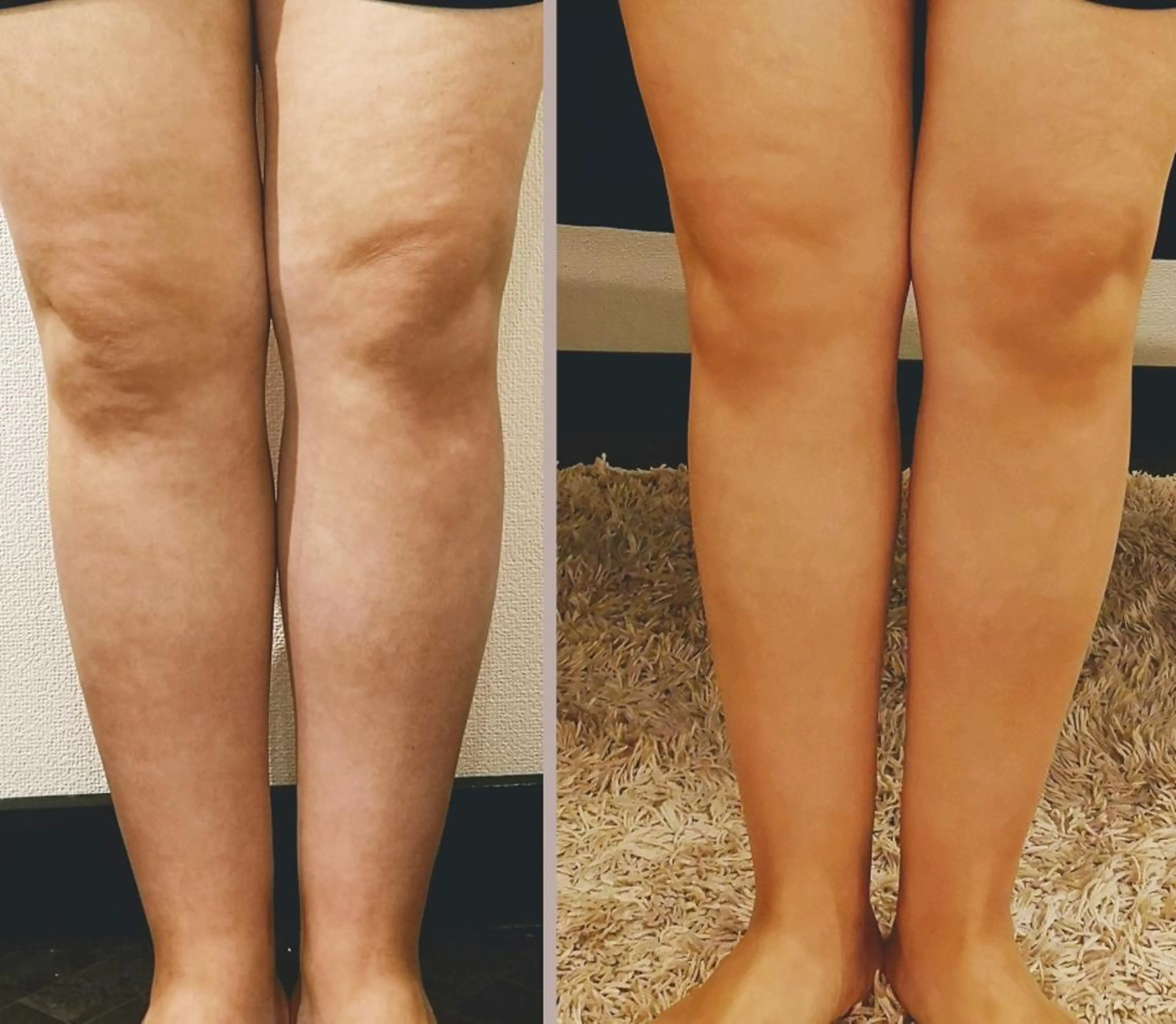 🅖🅤🅩🅔🅛 salonのエステ・リラクイメージ