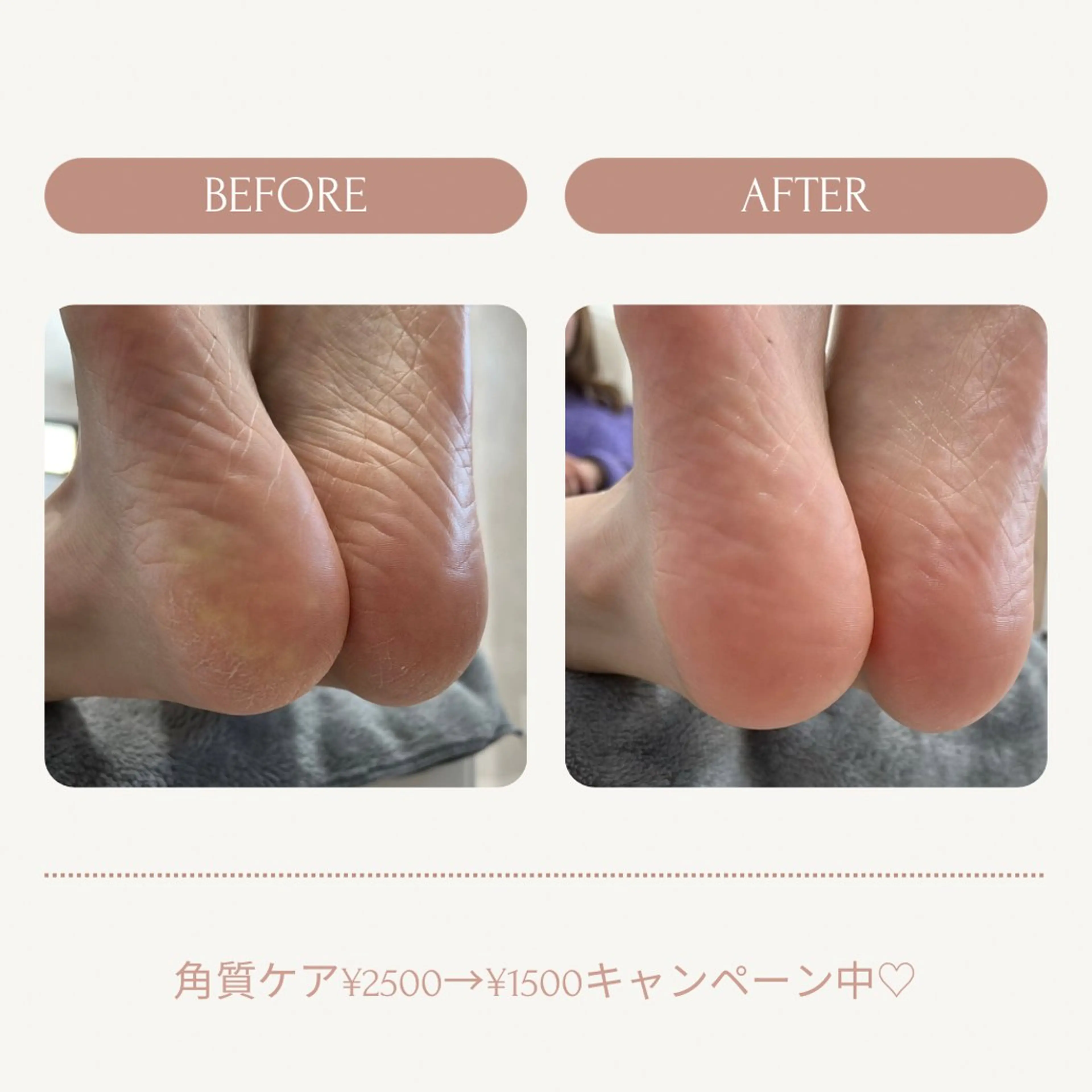 ネイル Aurum ♡︎ miyukiのネイルデザイン