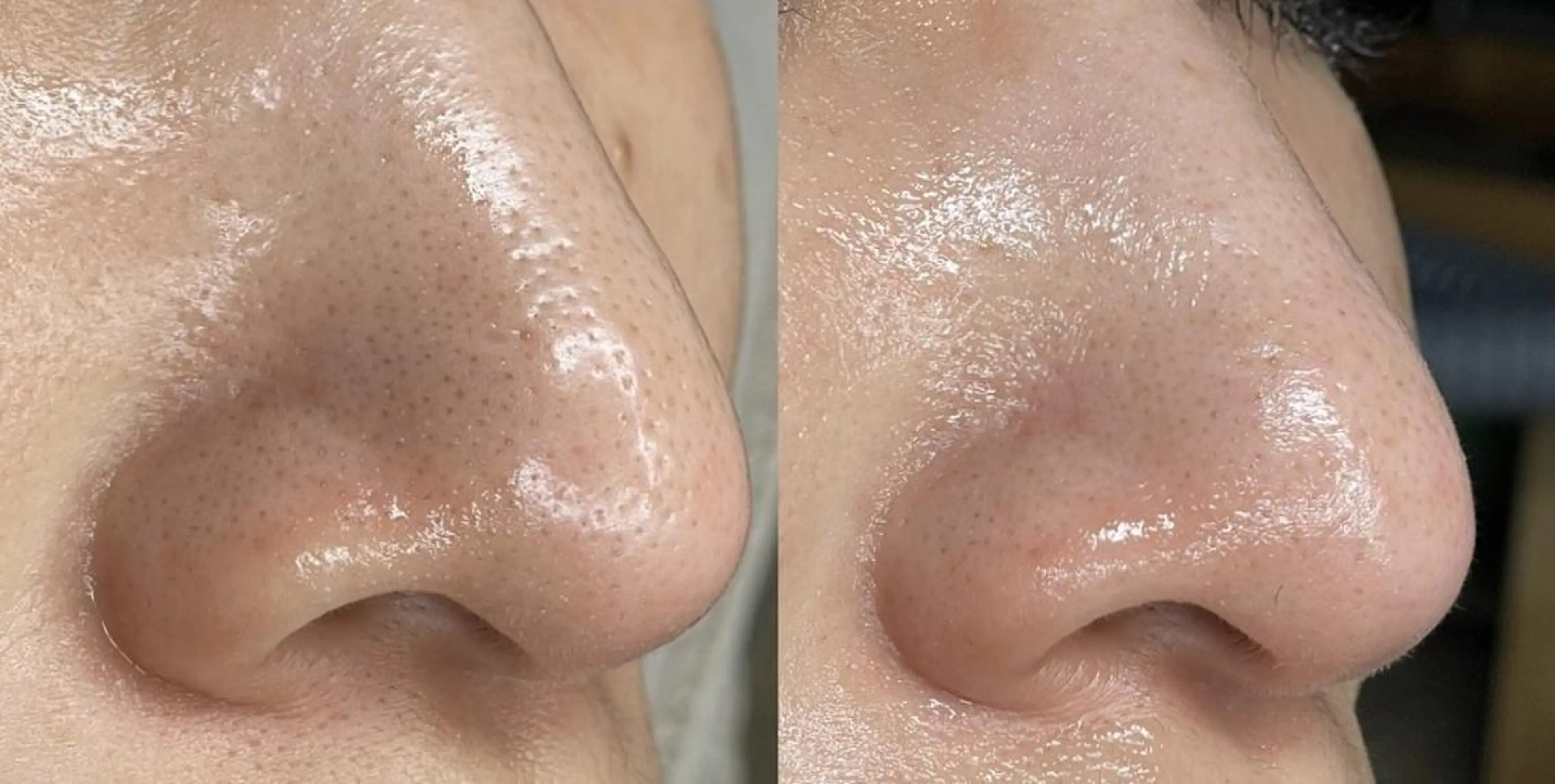 sii センター北 AIのエステ・リラクイメージ