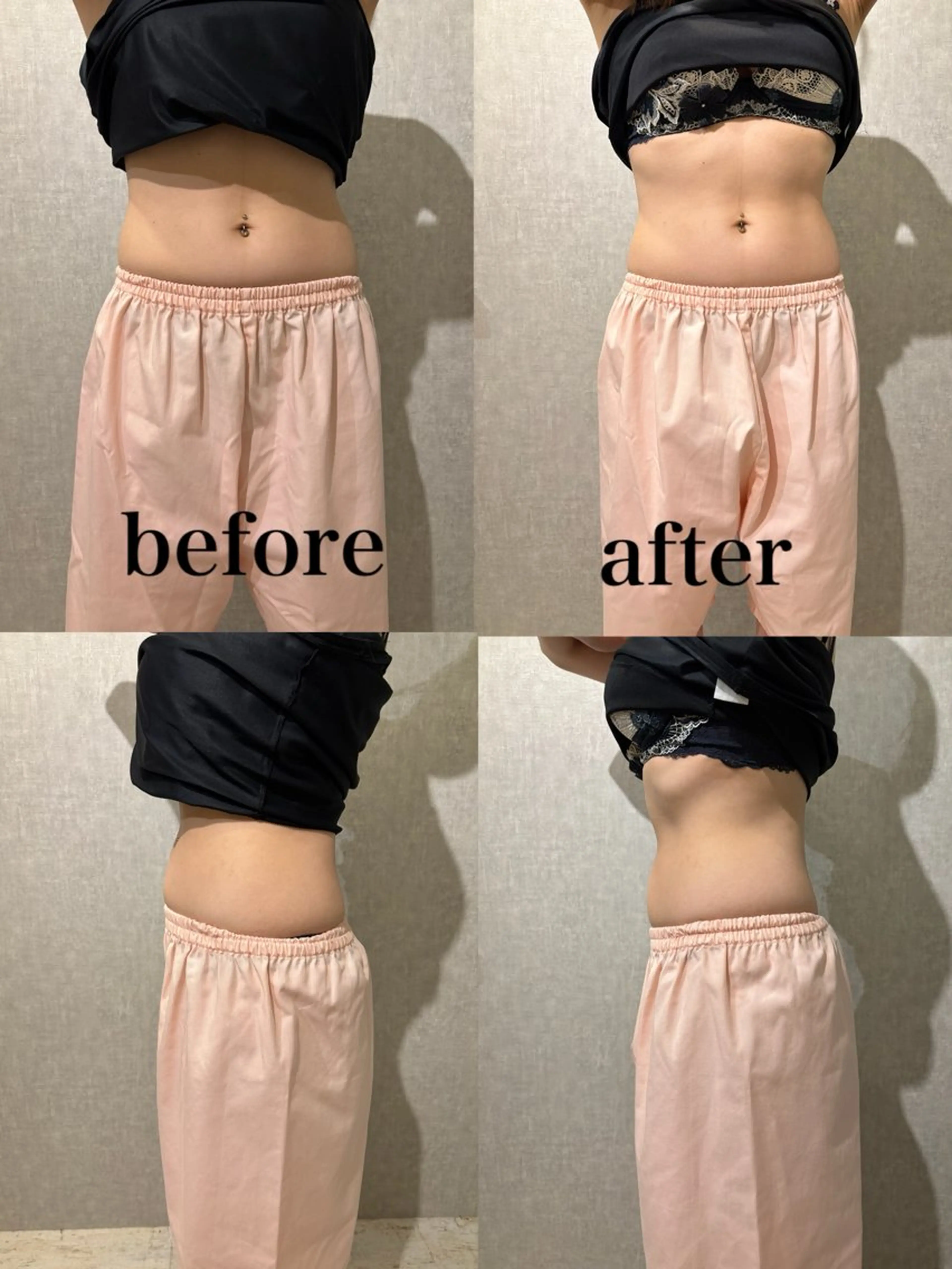 エステ リラク 腸活サポート みなみののエステ・リラクイメージ