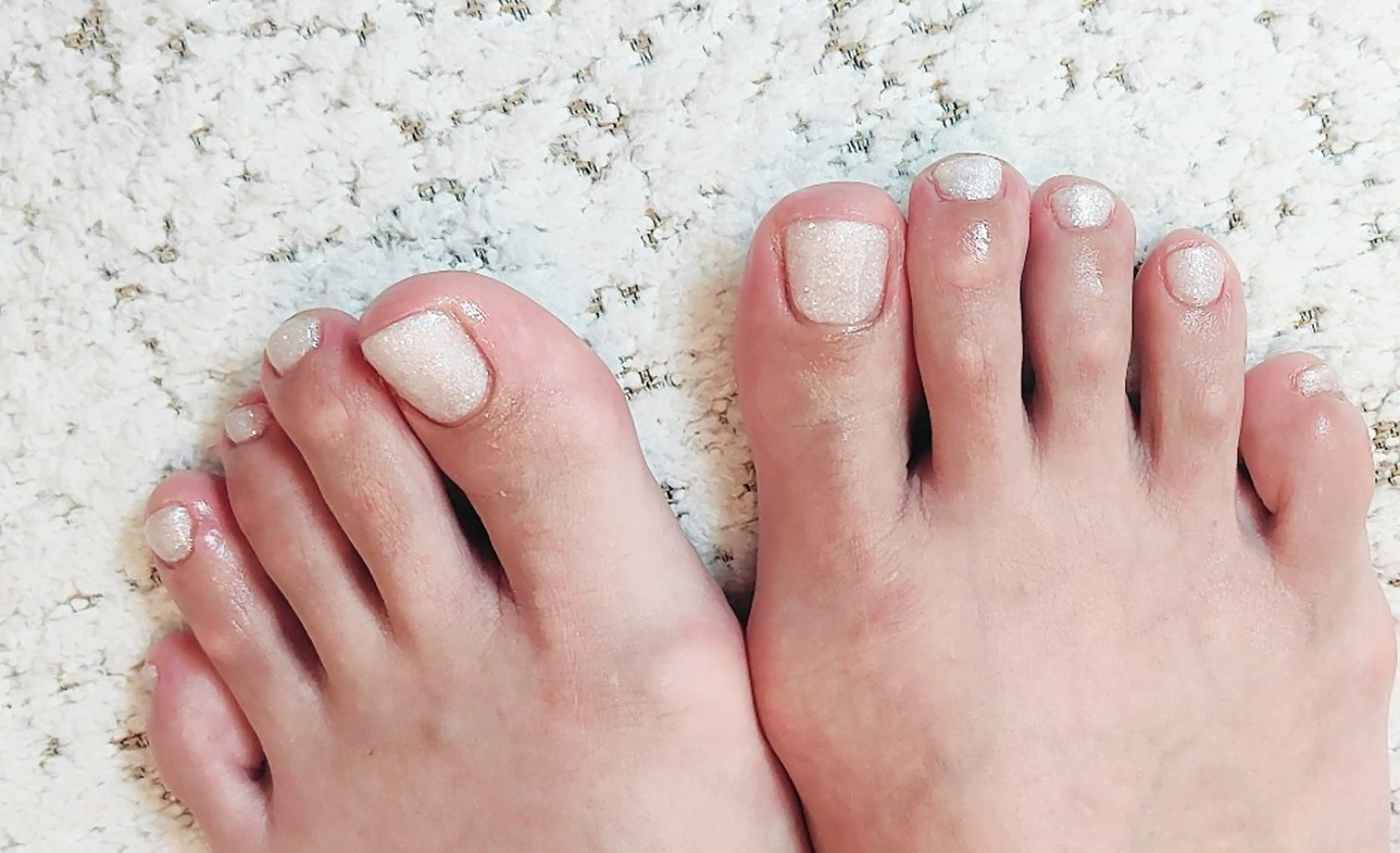 ネイル フットネイル sunny nail もっちのネイルデザイン