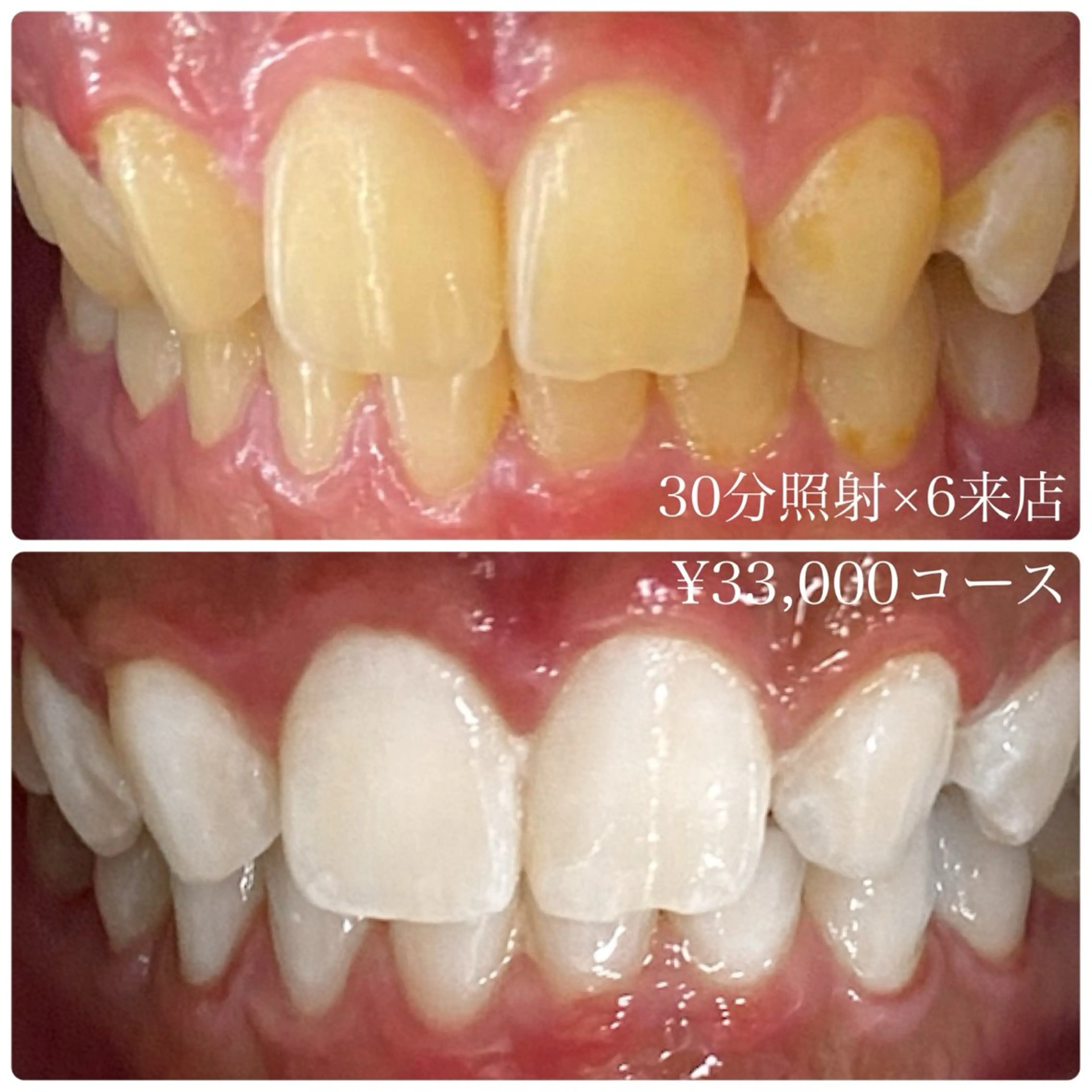 メンズ その他 ホワイトニングルーム　川崎店所属・ホワイトニング ルーム　川崎店のその他イメージ