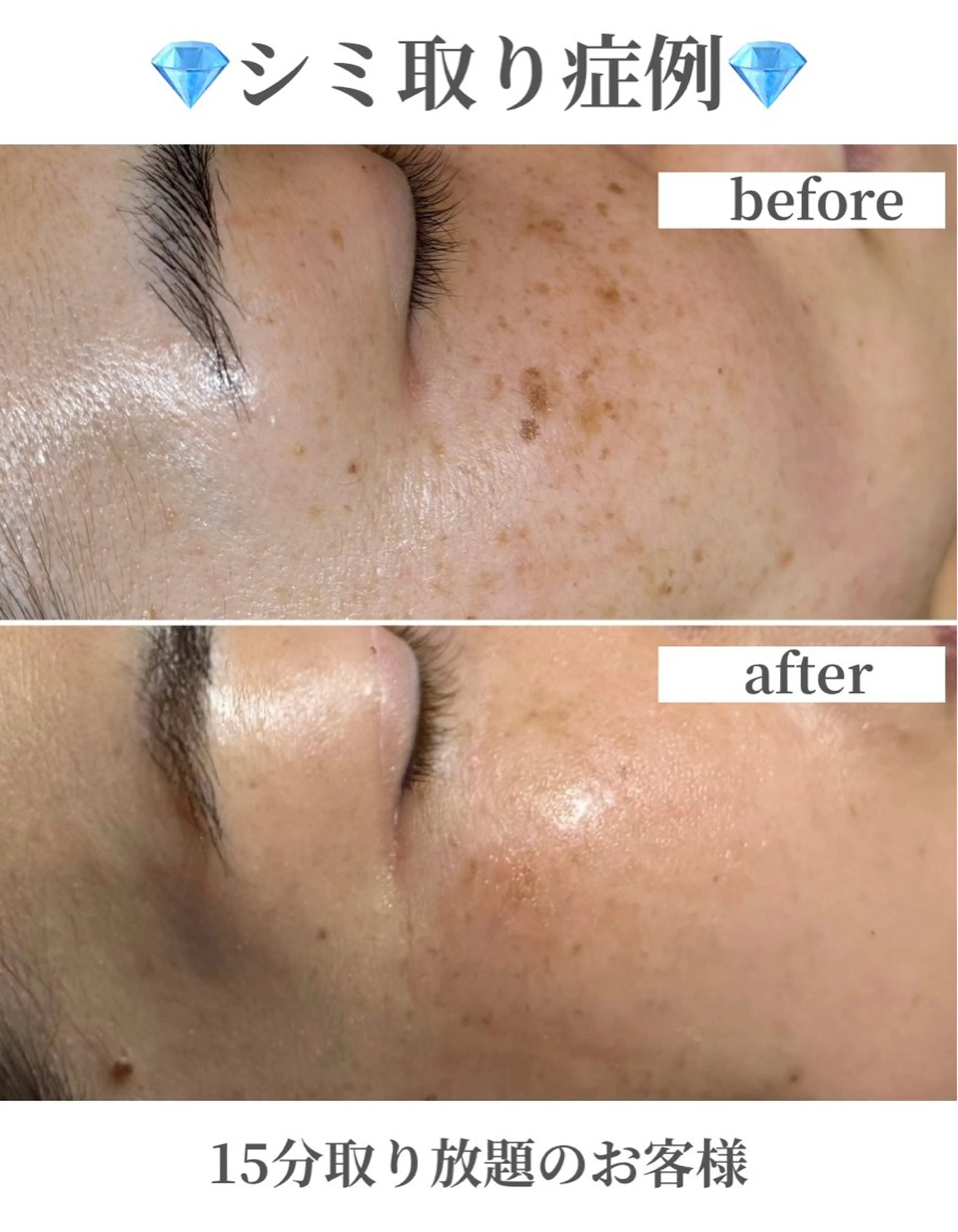 なにわのシミ取り職人 YUKIのエステ・リラクイメージ