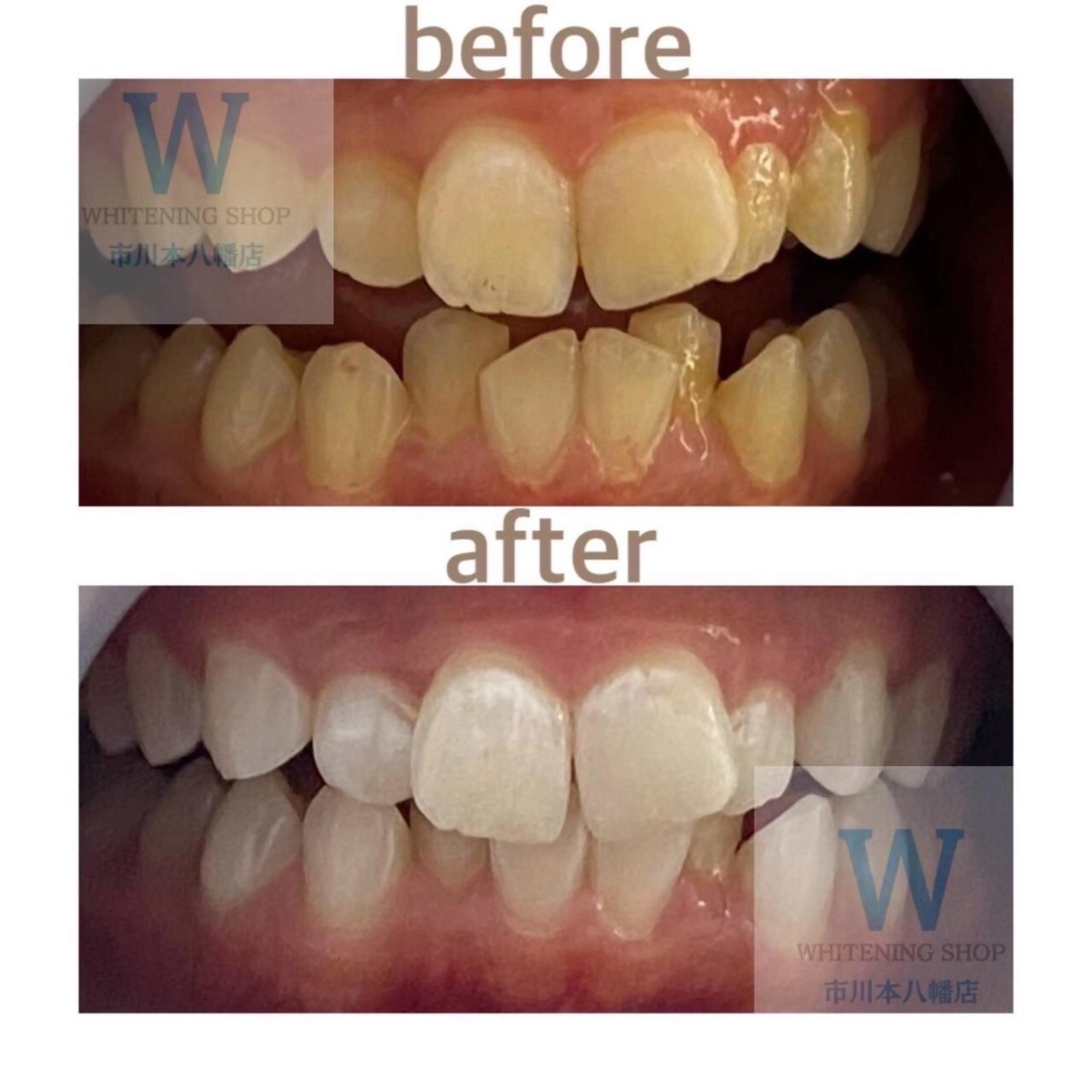 ホワイトニング ショップ本八幡店のエステ・リラクイメージ