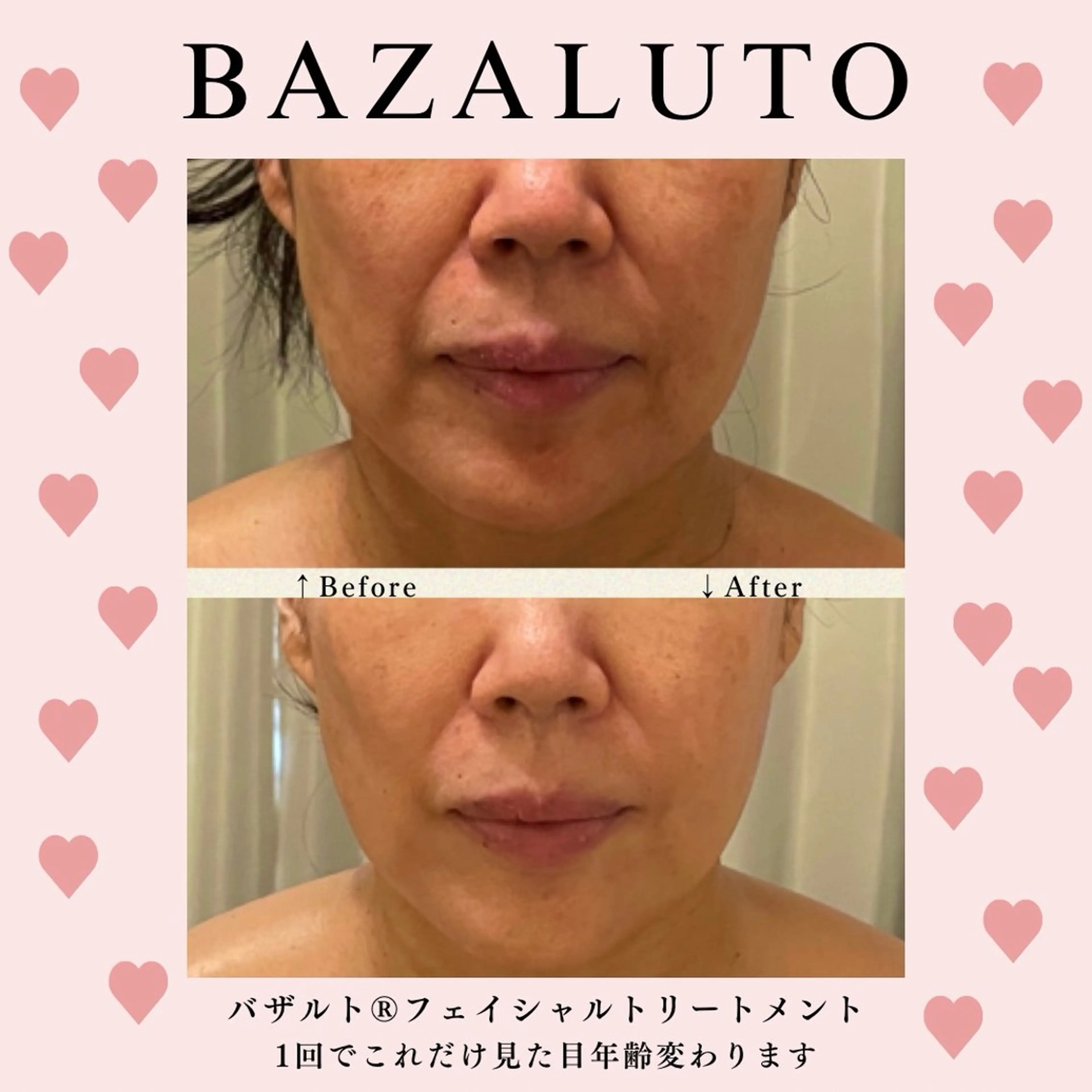 糸島 エステサロンmiuのエステ・リラクイメージ