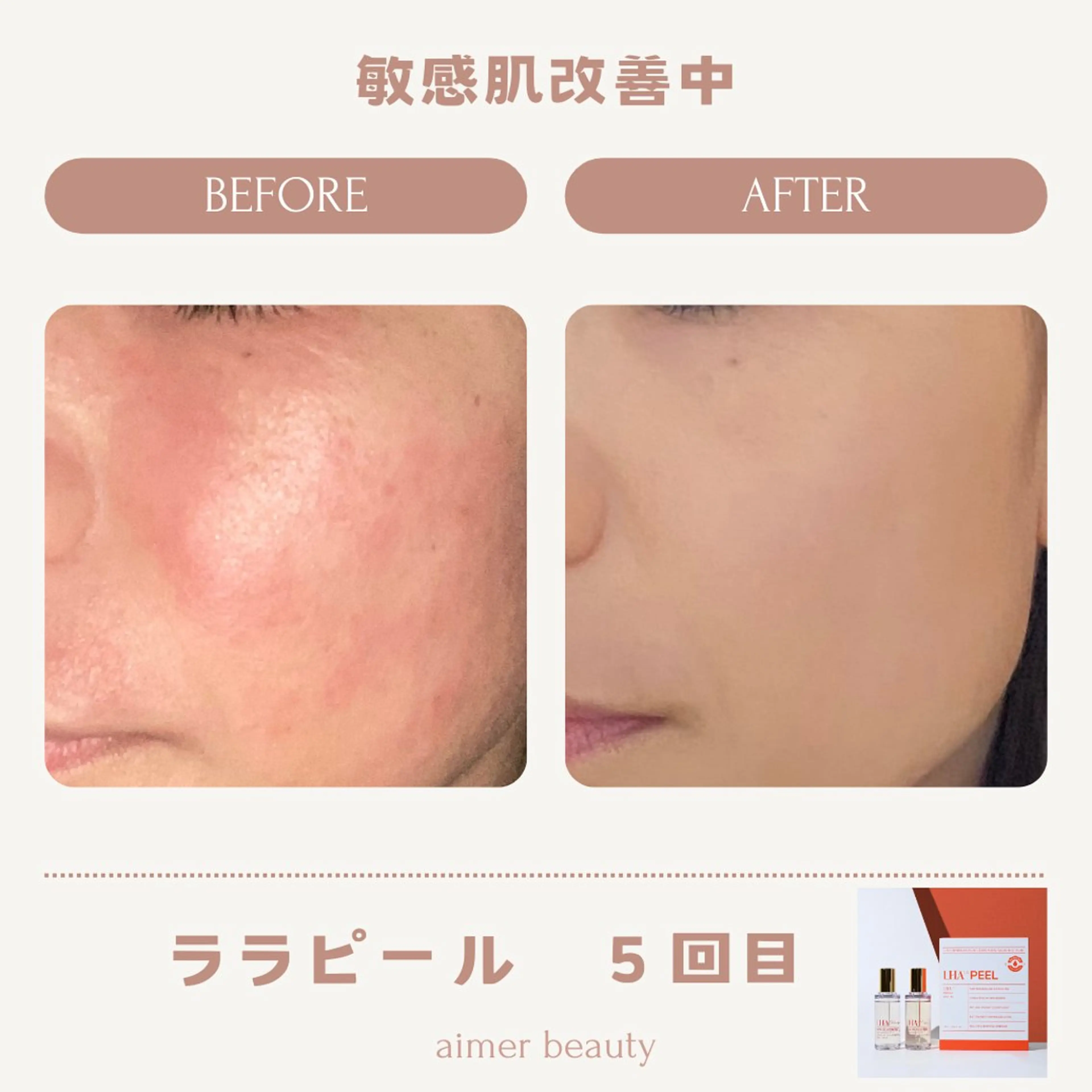 エステ aimer beautyのエステ・リラクイメージ