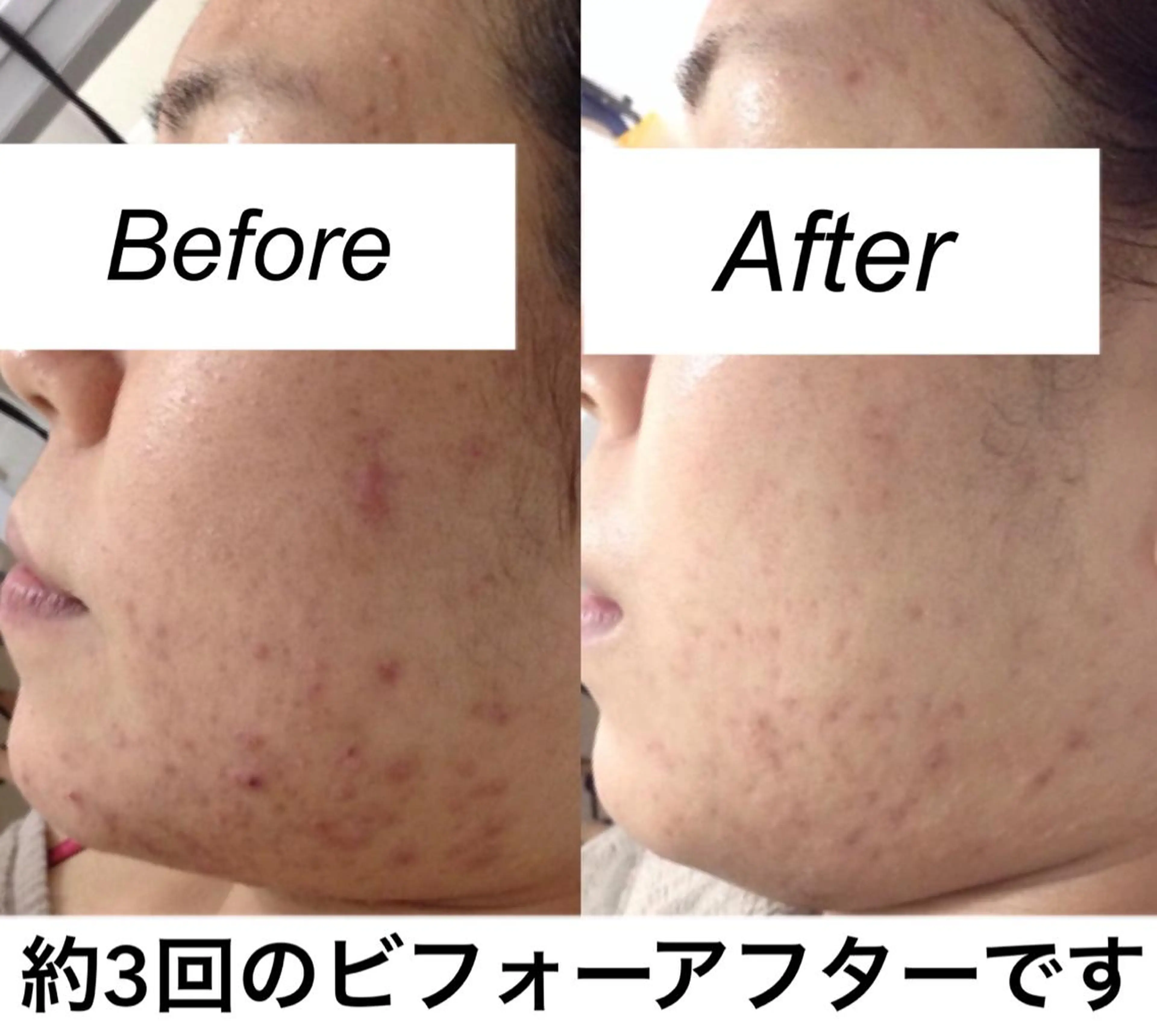 ネイル マツエク・マツパ エステ リラク 都度払い肌質改善 &脱毛Blancheのエステ・リラクイメージ