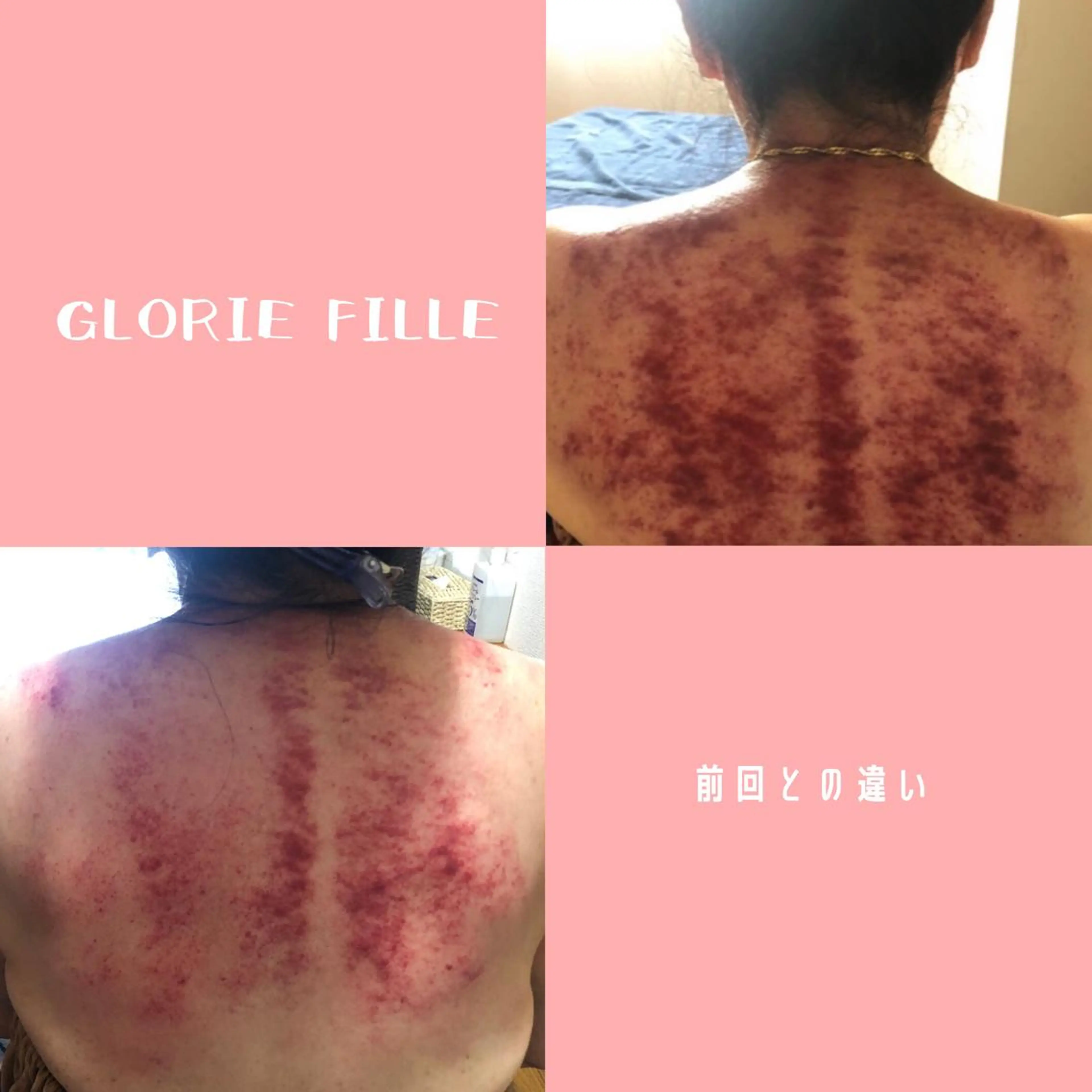 女性専用かっさサロン gloriefille所属・女性専用かっさサロン glorieのエステ・リラクイメージ