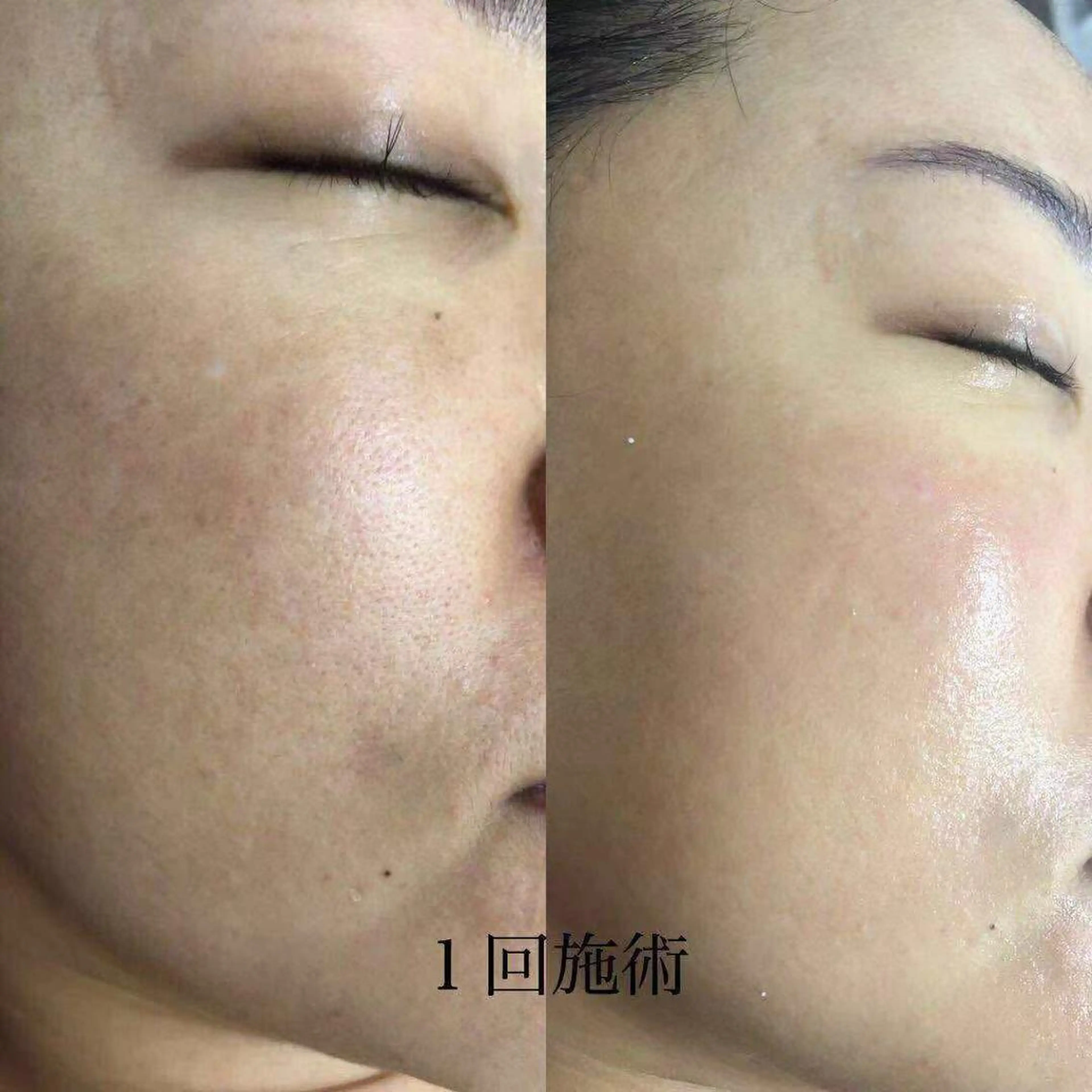 アロマビューティー カオリのネイルデザイン