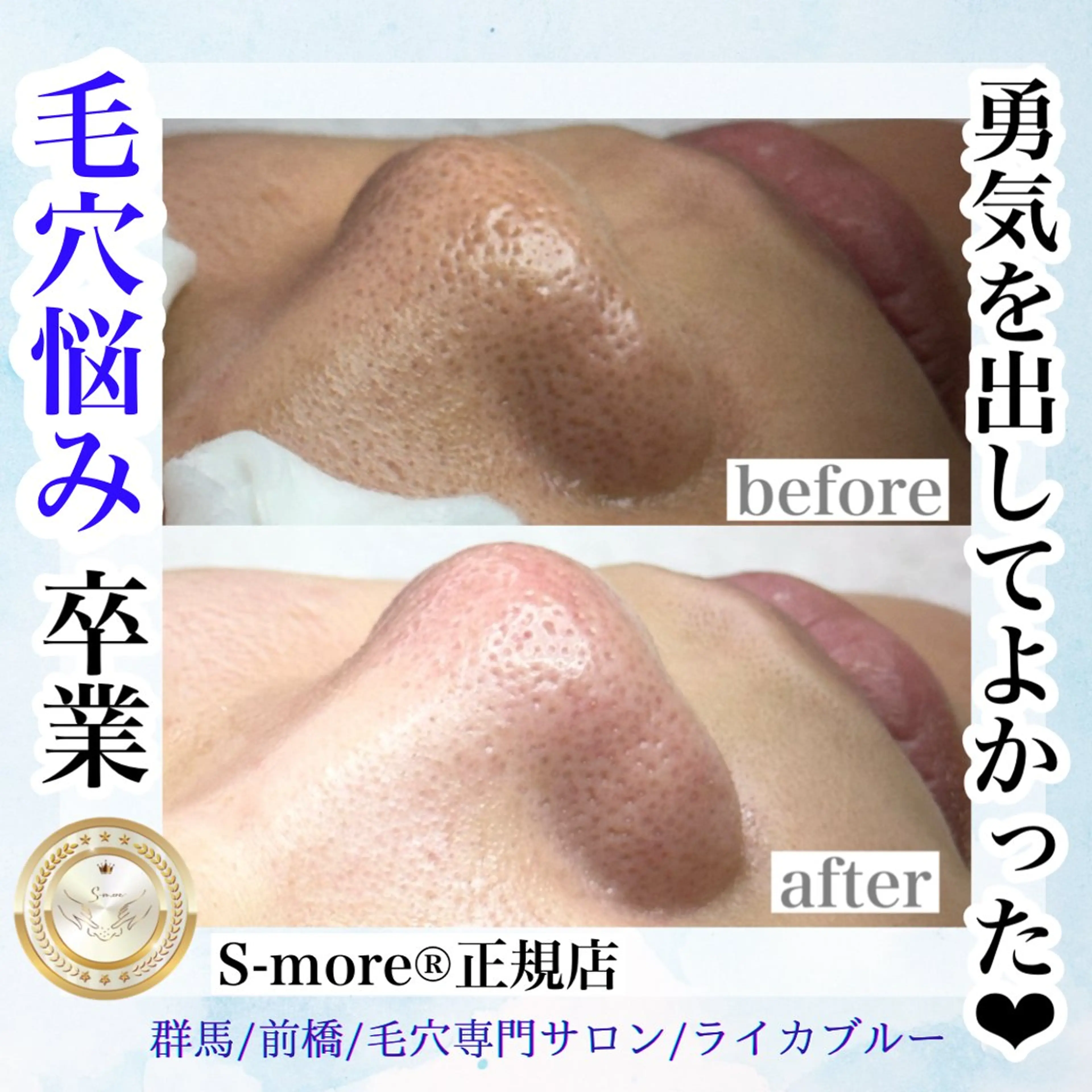 毛穴専門サロン ライカブルーのエステ・リラクイメージ