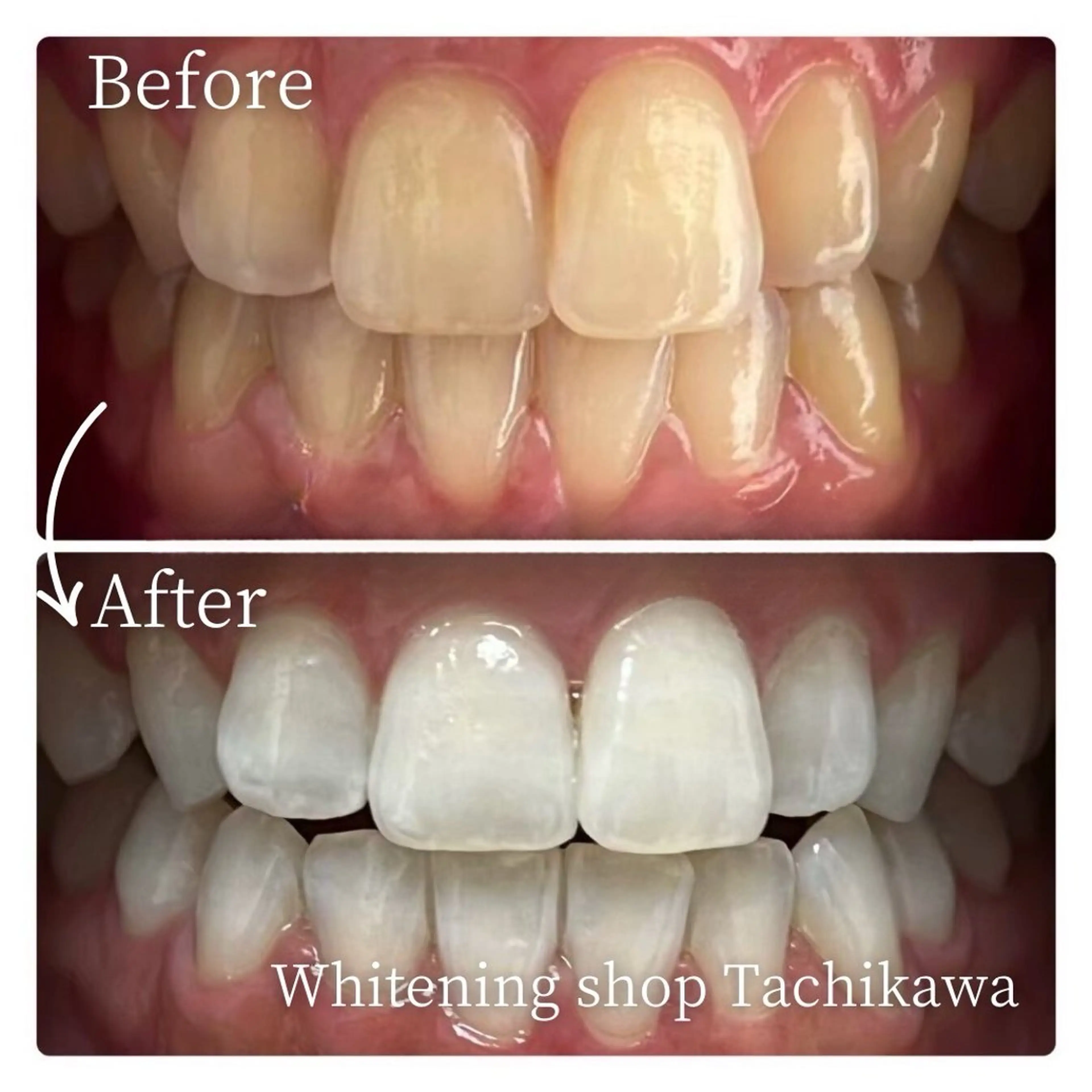 セルフ　ホワイト ニングショップ立川のその他イメージ