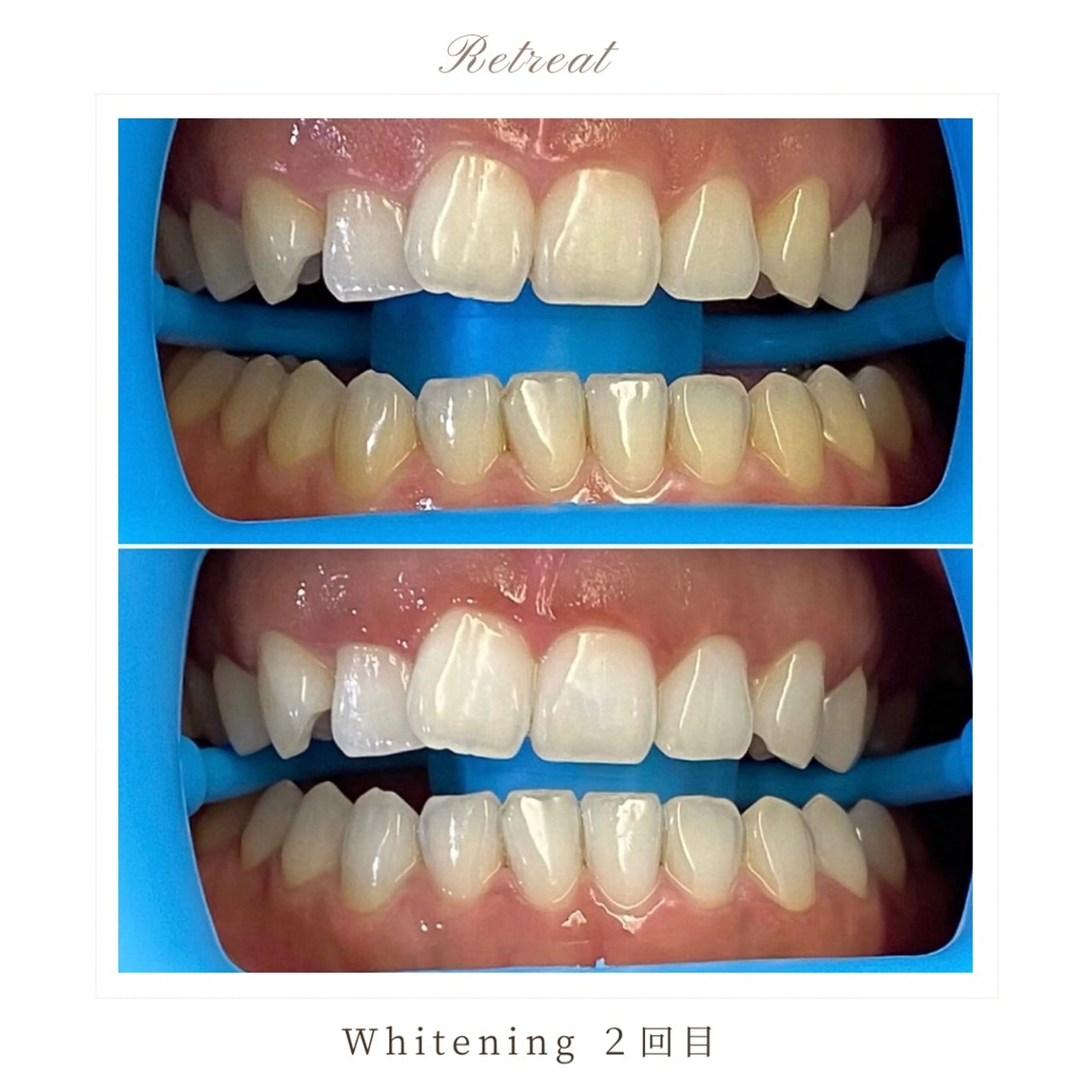 Retreatリトリート所属・歯科医院提携 Retreatのエステ・リラクイメージ