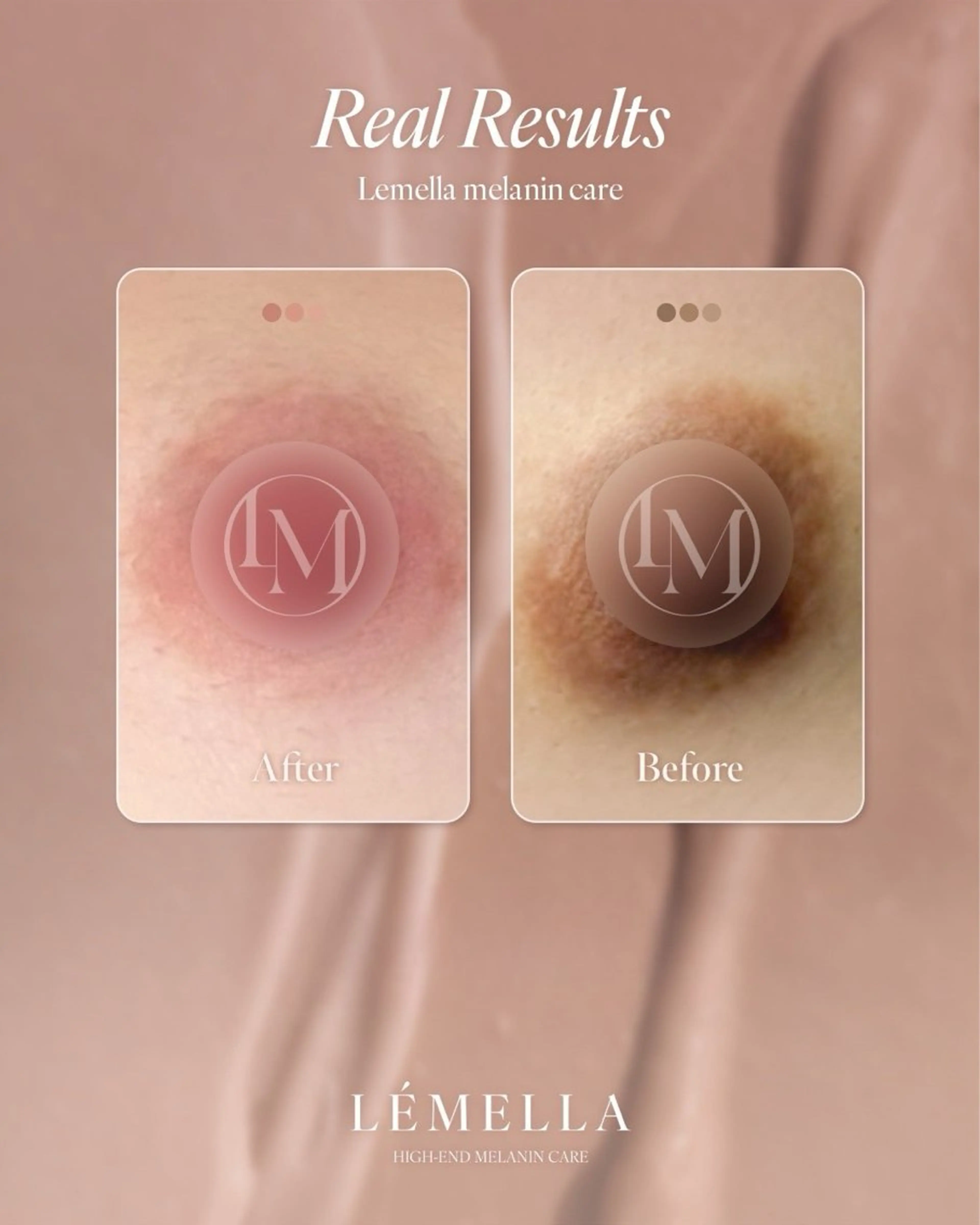 最新メラニンケア　乳輪の写真