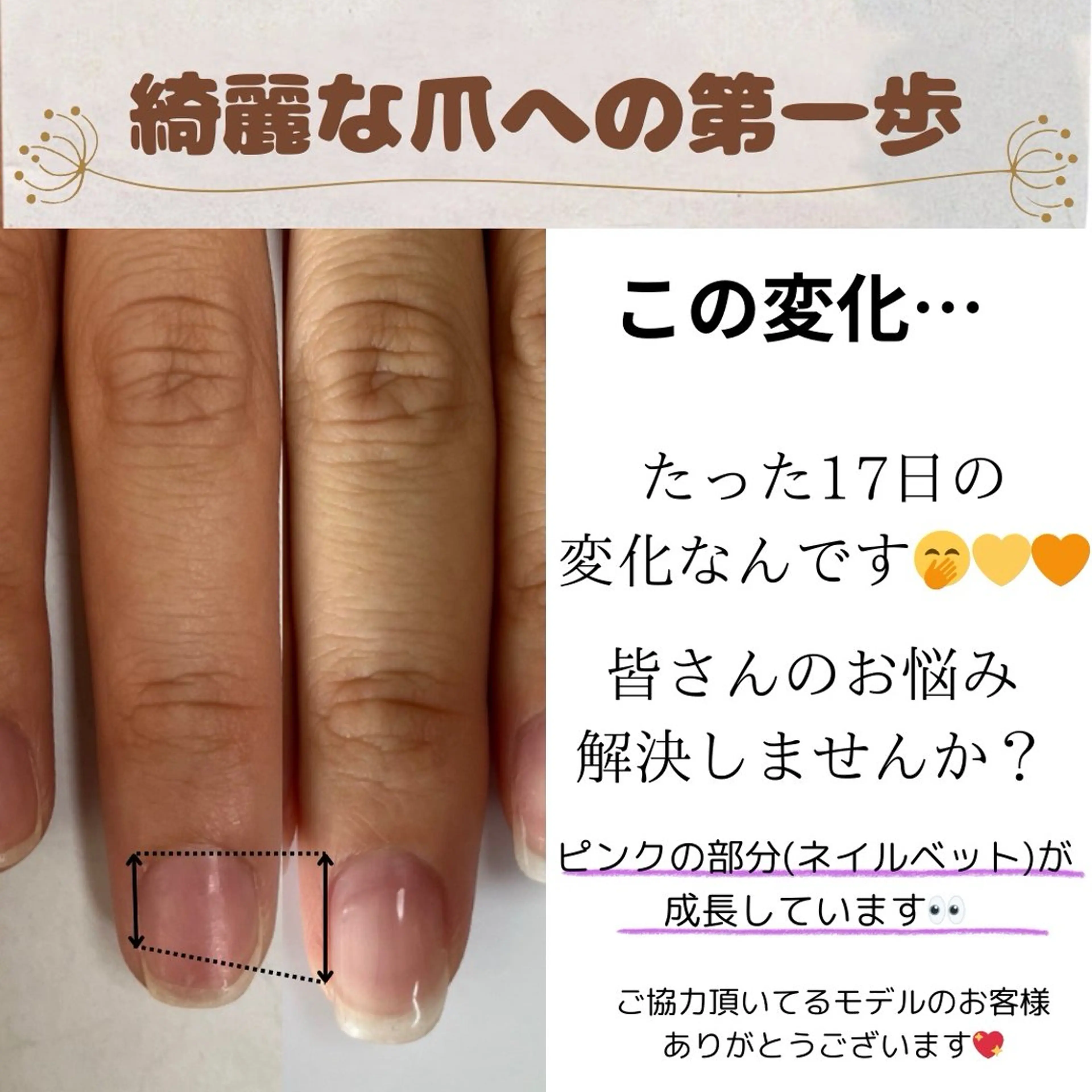自爪育成💖クリア仕上げ✨　　　　　　　　　　　　　　　２回目以降はカラーなどデザインメニュー追加可能◎の写真