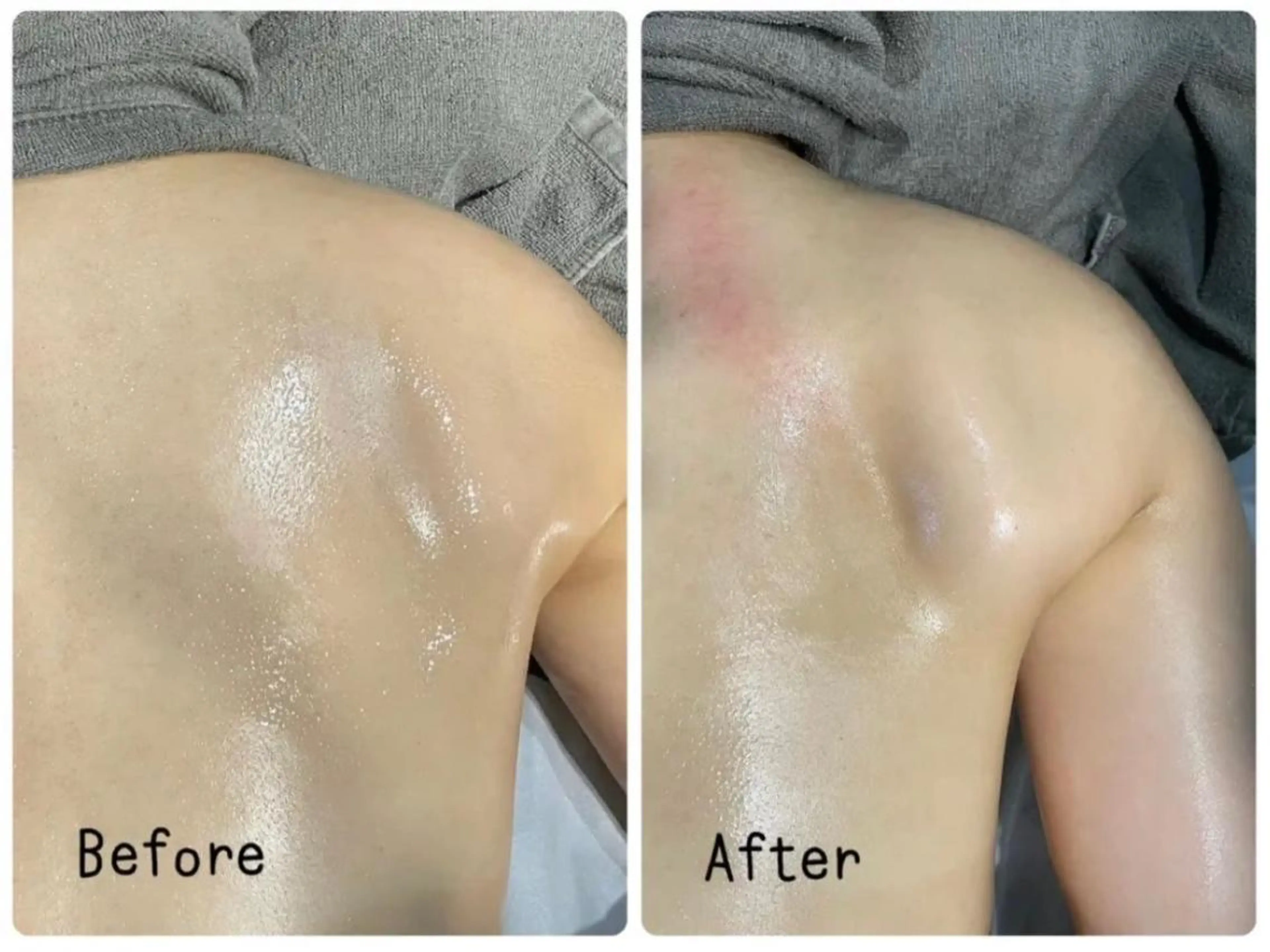 リラク Gemini 　MIKIのエステ・リラクイメージ