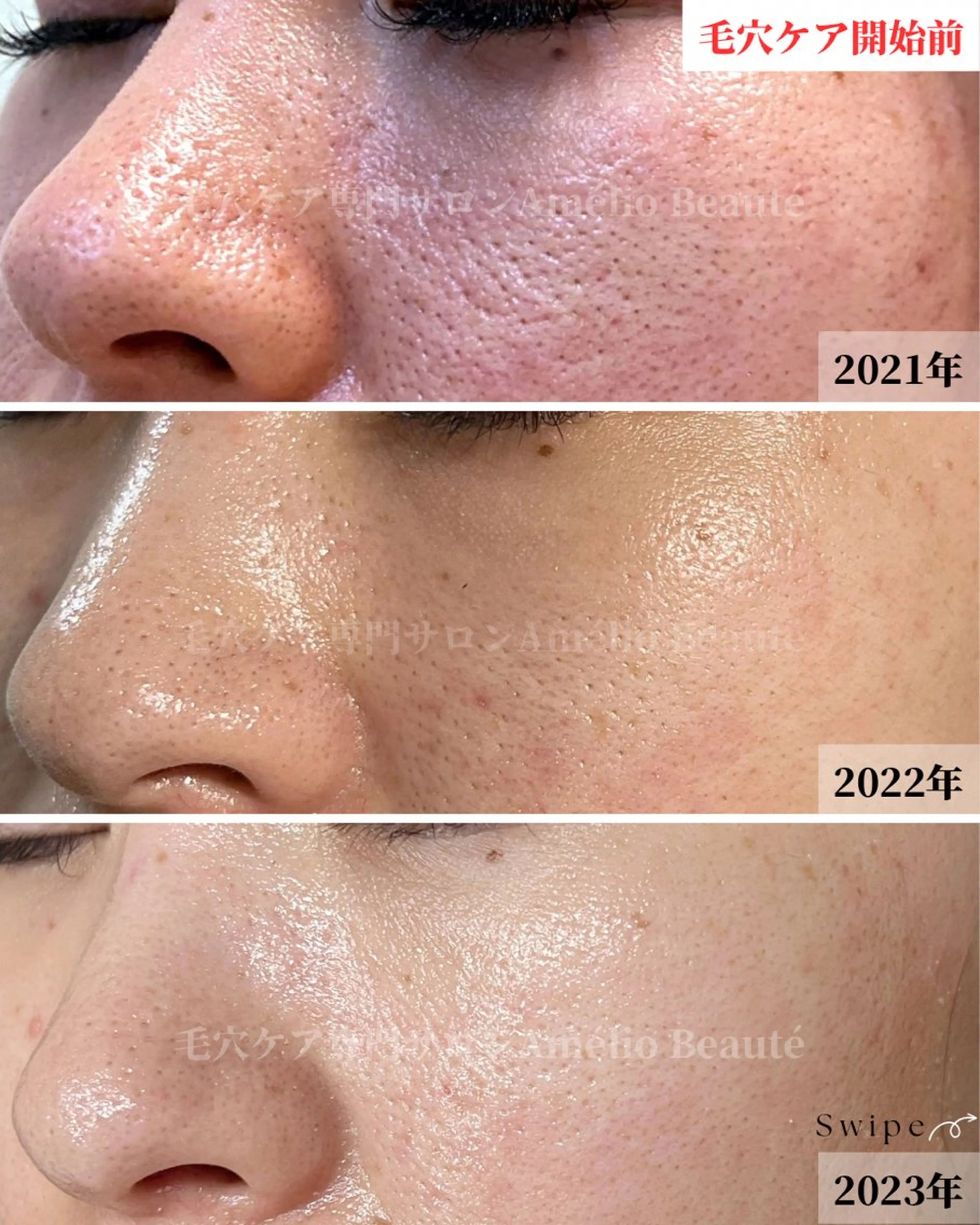 メンズ 毛穴ケア専門サロン Amélio Beauté所属・毛穴ケア専門サロン アメリオボーテのその他イメージ