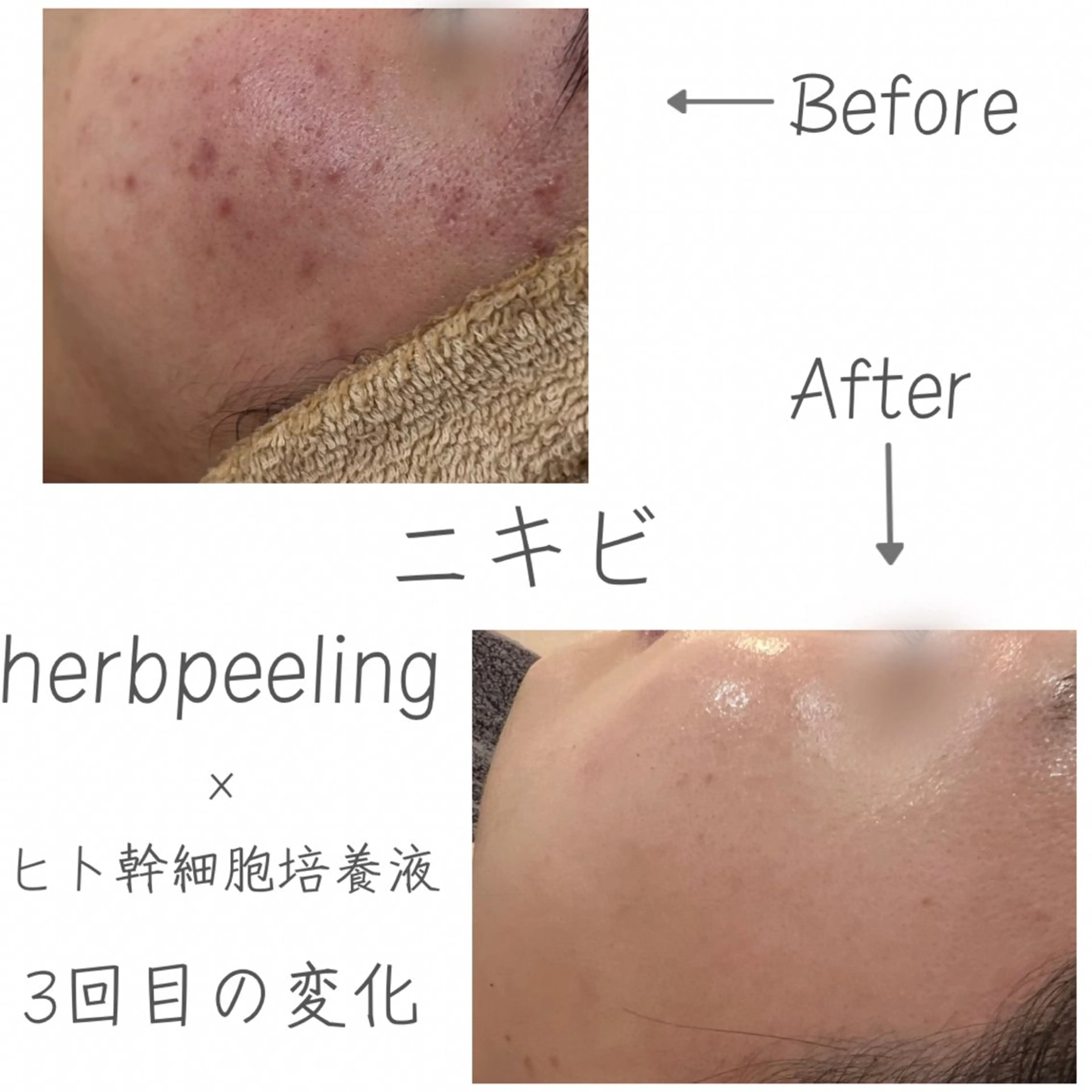 ｍｉkｉ 東根の肌質改善サロンのエステ・リラクイメージ