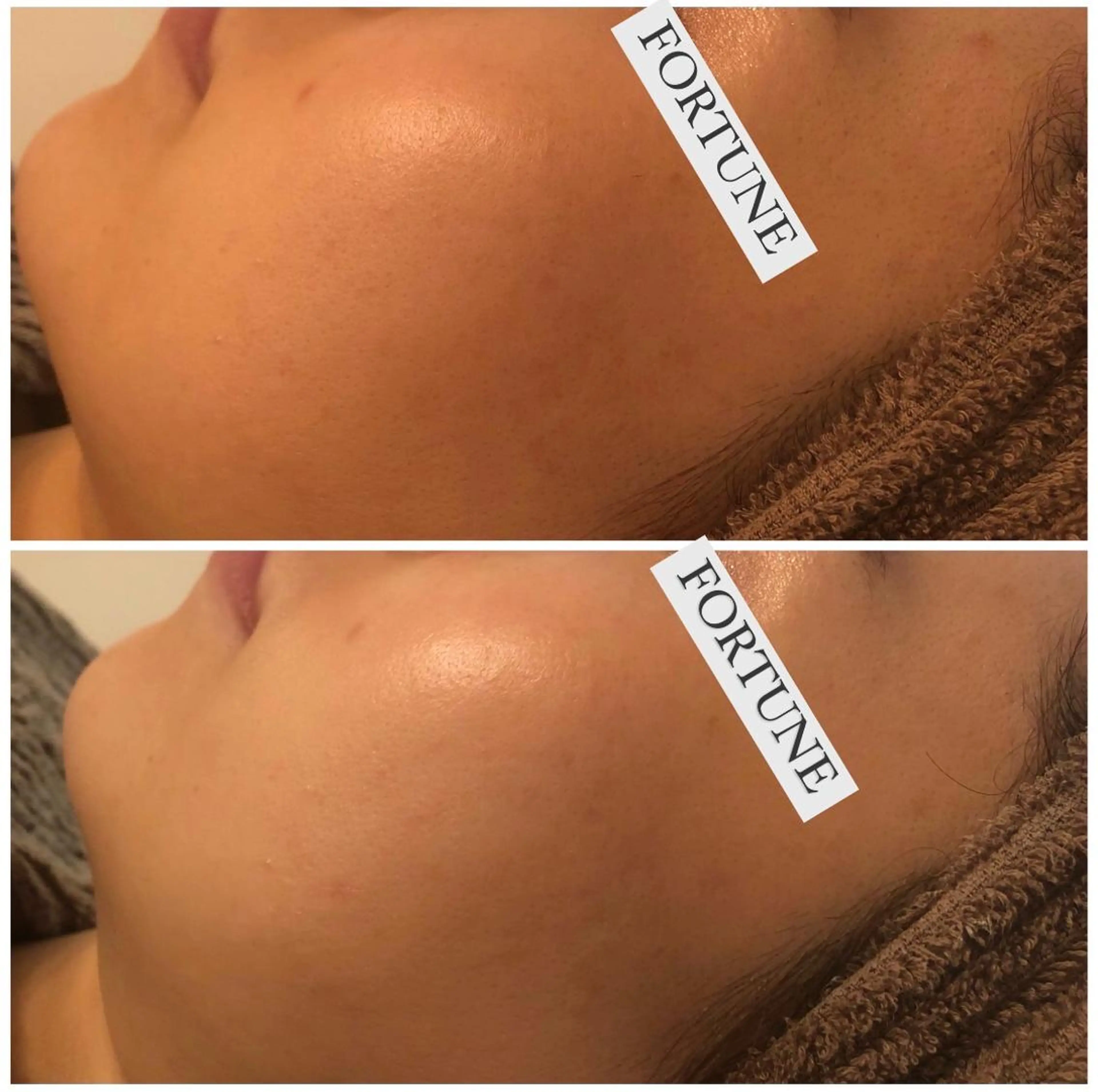 エステ fortune横浜 天王町のその他イメージ